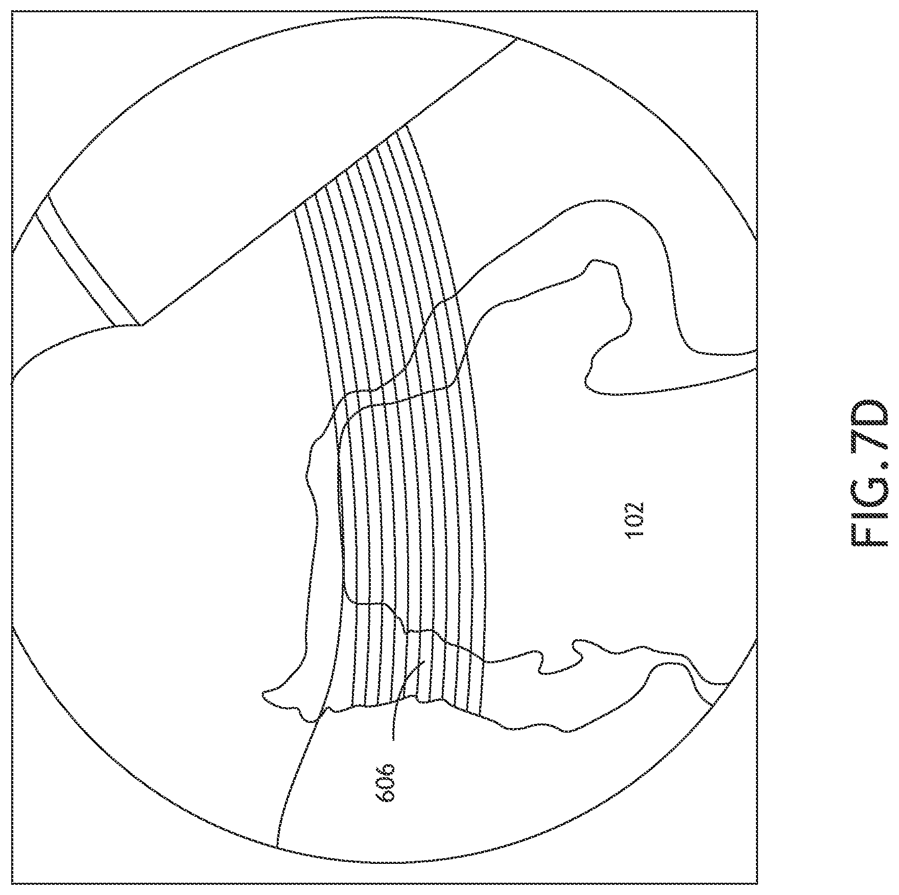Patent US12588460 Figure 14 – Sensor configuration for process condition measuring devices