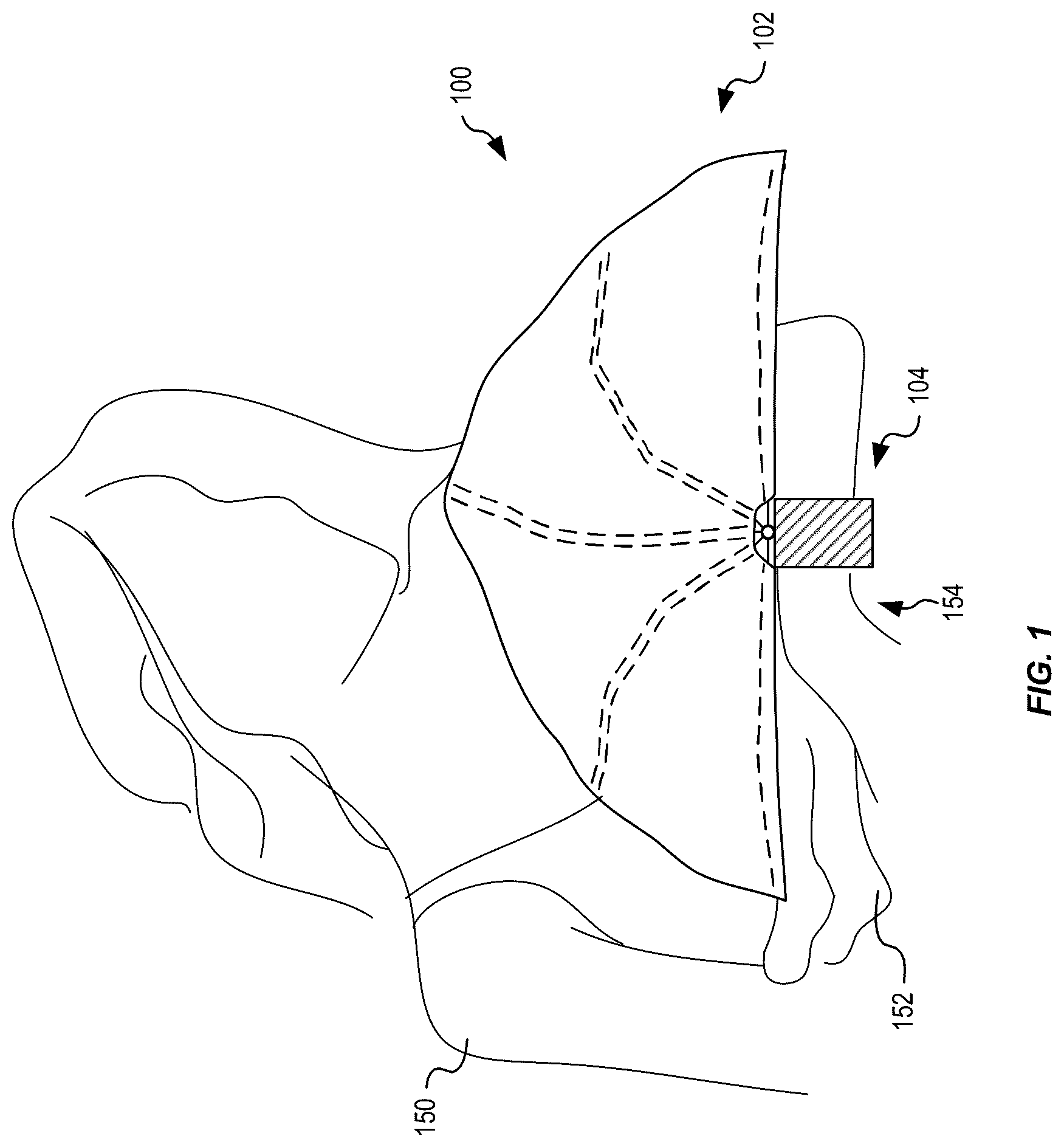 Patent US12588716 Figure 1 – Arm-mounted breastfeeding cover