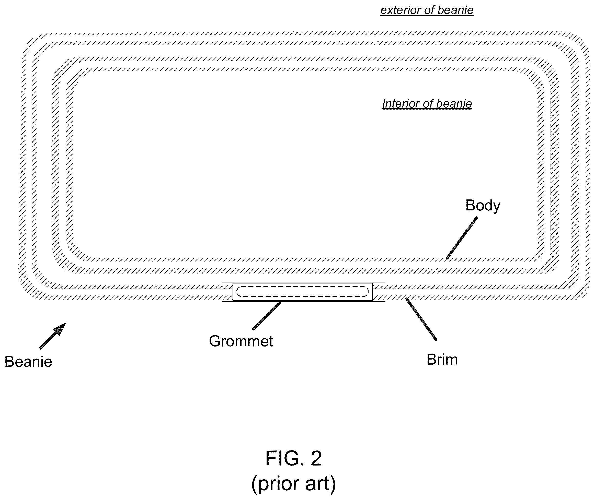 Patent US12588722 Figure 2 – Headgear comprising headbands for receiving removable light apparatus and methods of making