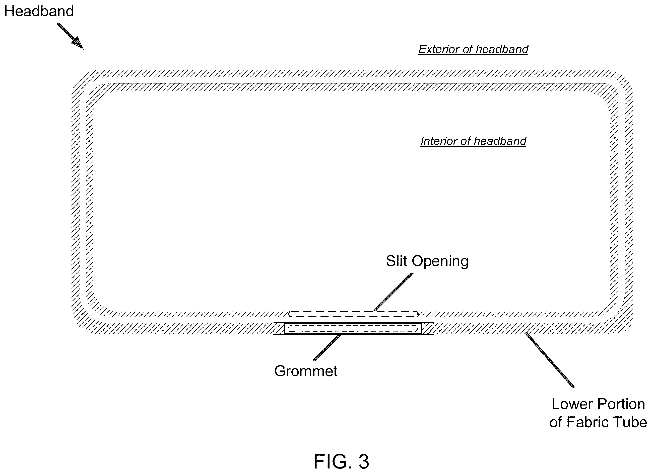 Patent US12588722 Figure 3 – Headgear comprising headbands for receiving removable light apparatus and methods of making