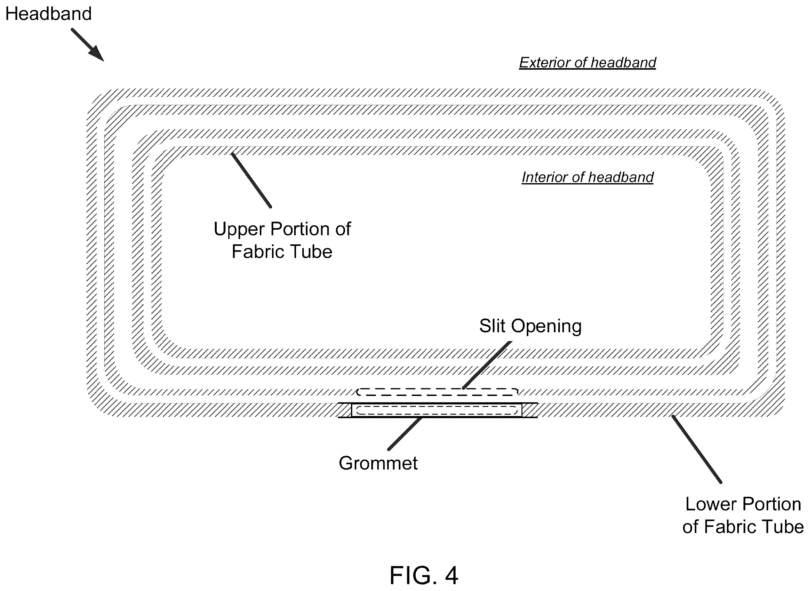 Patent US12588722 Figure 4 – Headgear comprising headbands for receiving removable light apparatus and methods of making
