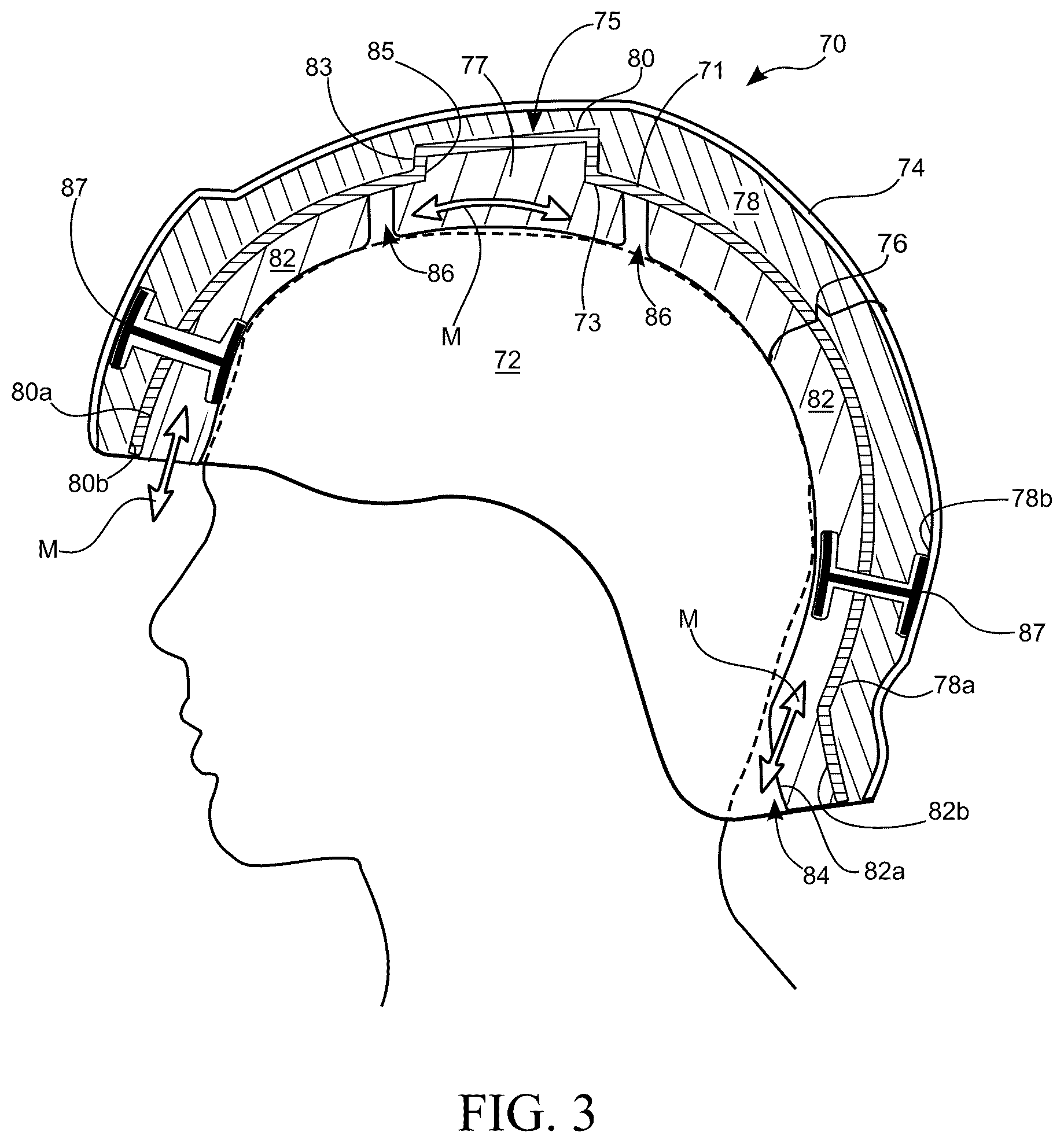 Patent US12588726 Figure 7 – Multi-layer helmet and method for making the same