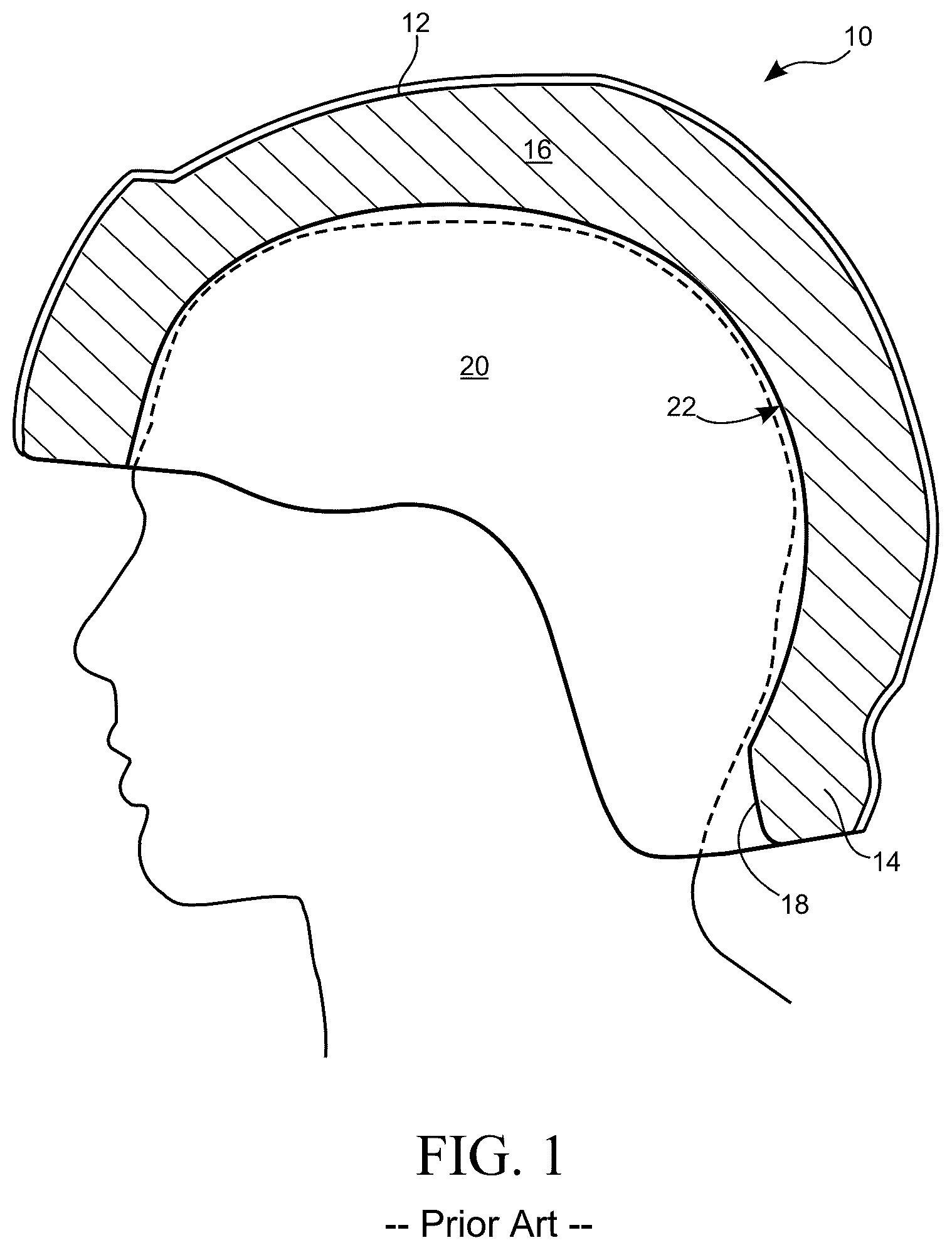 Patent US12588727 Figure 1 – Multi-layer helmet and method for making the same