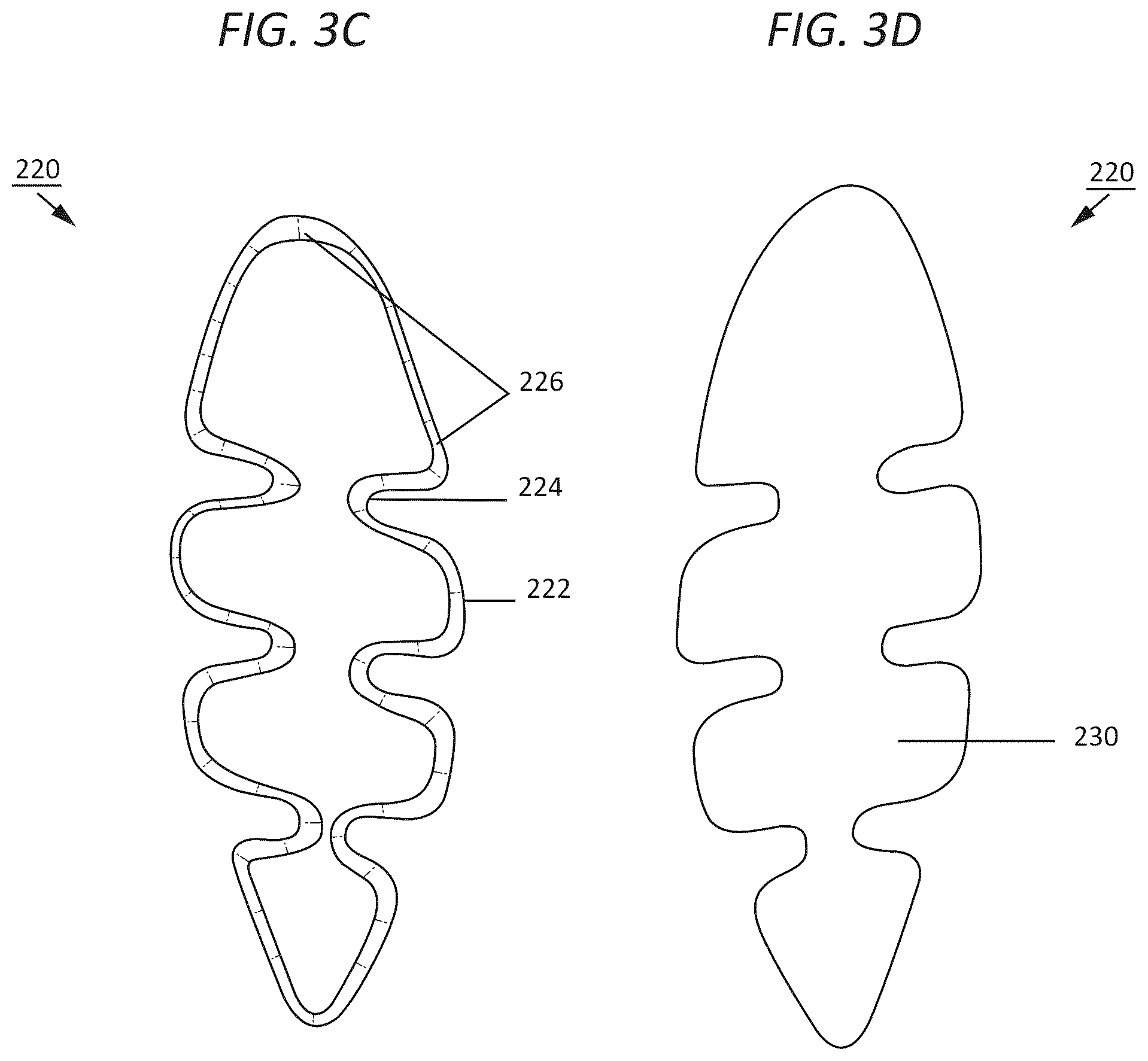 Patent US12588736 Figure 6 – Foamed sole components and method for making a sole with foamed sole components