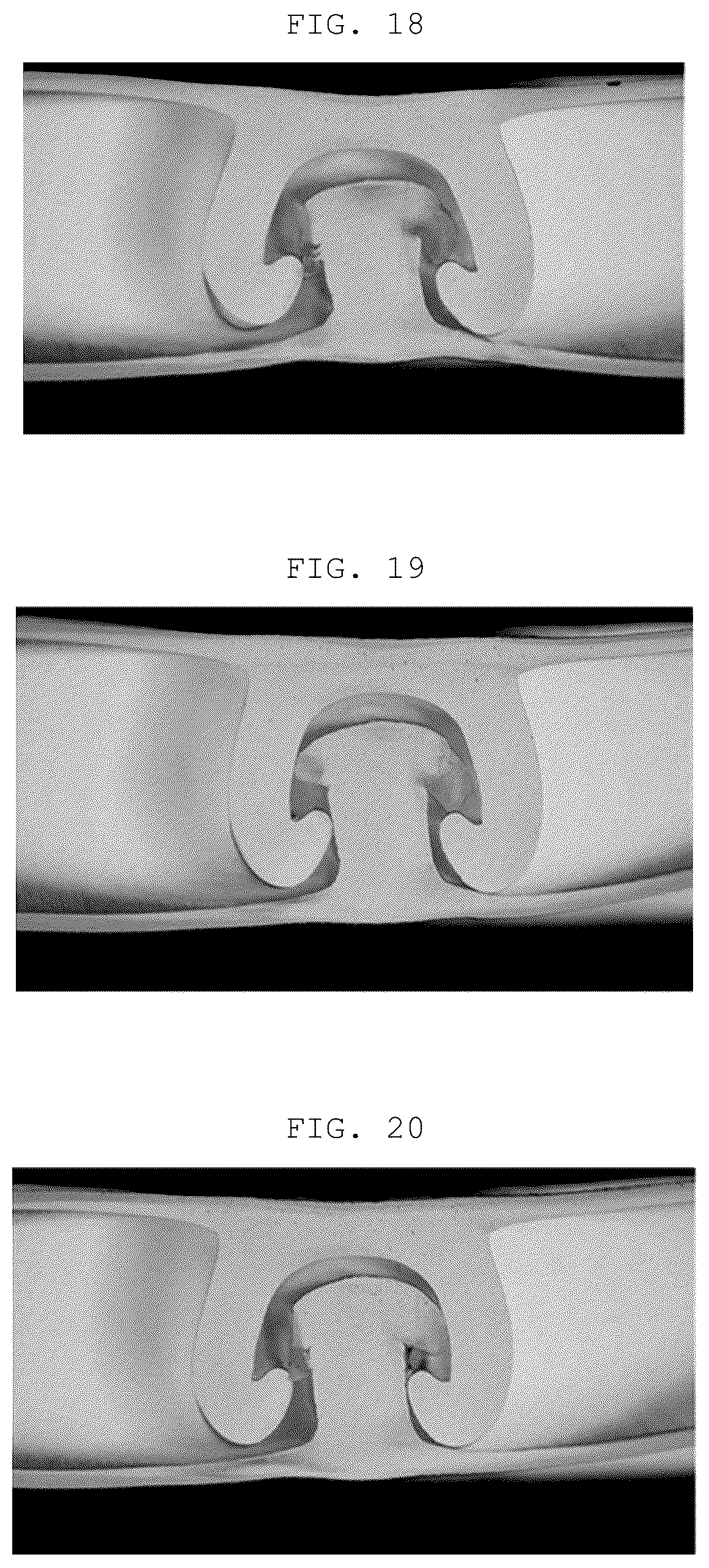 Patent US12588739 Figure 13 – Zipper strap structure, packaging bag comprising zipper strap structure, and manufacturing method for zipper strap structure