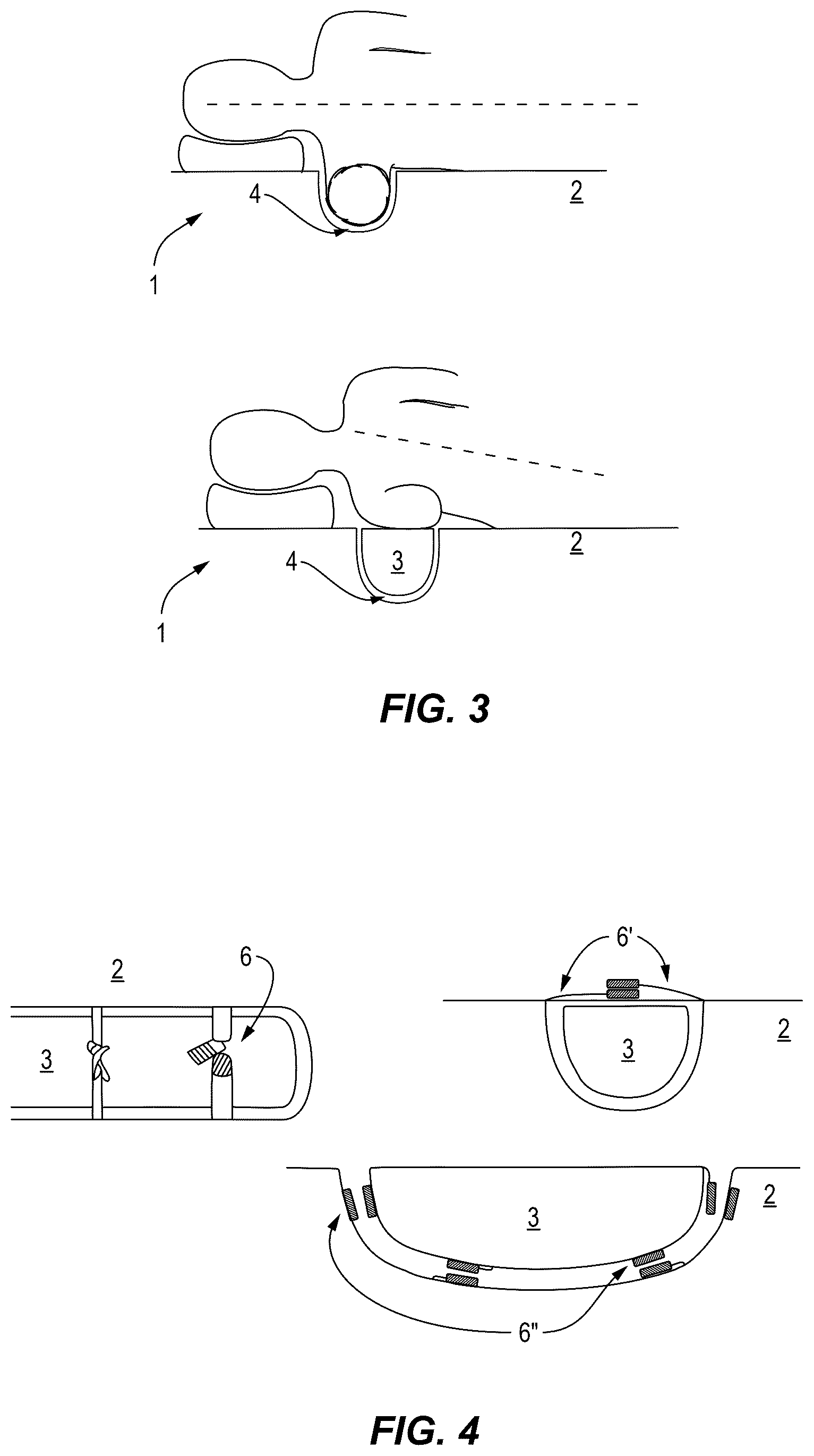 Patent US12588767 Figure 2 – Functional mattress