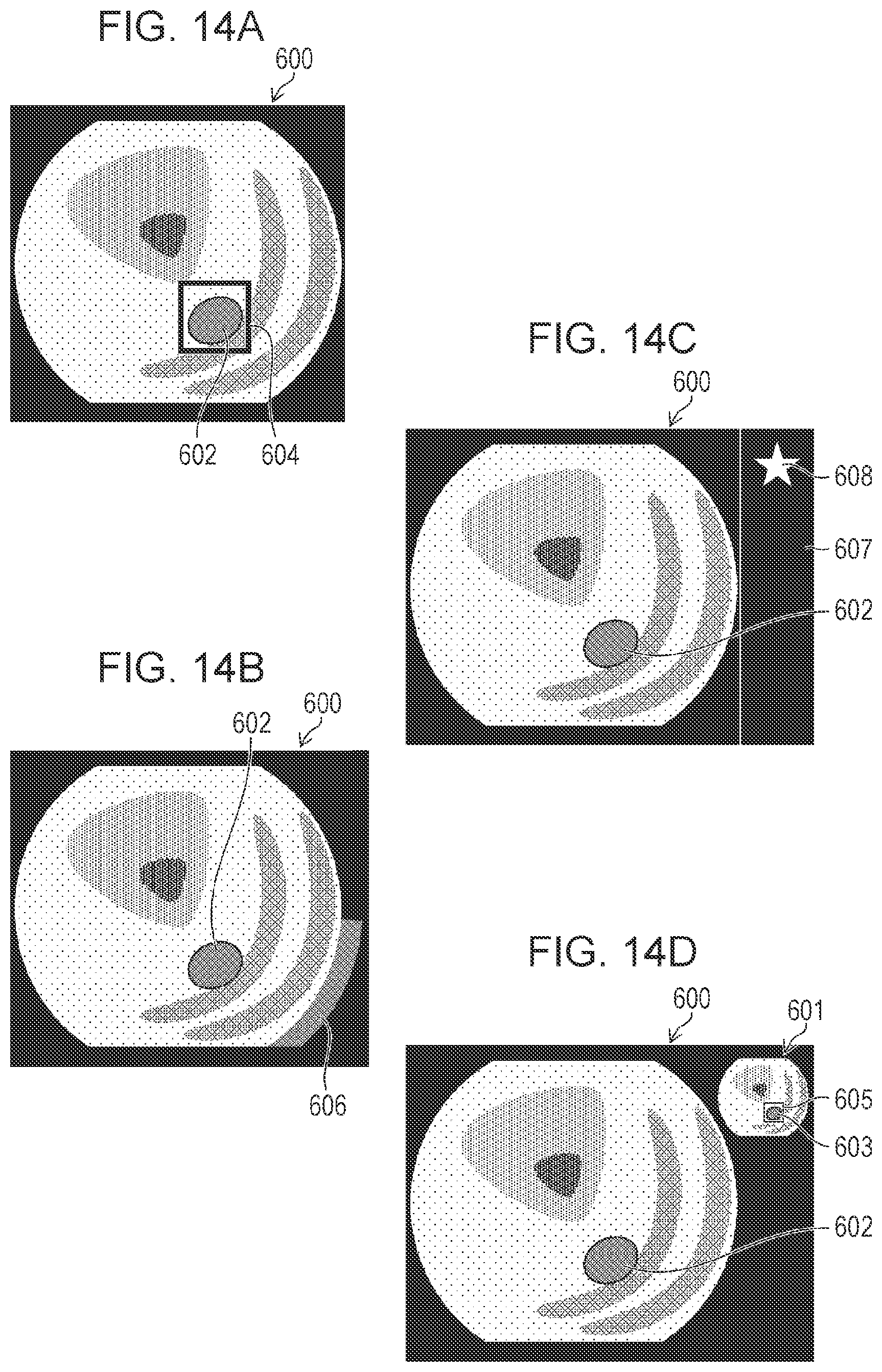 Patent US12588799 Figure 10 – Image diagnosis assistance apparatus, endoscope system, image diagnosis assistance method, and image diagnosis assistance program