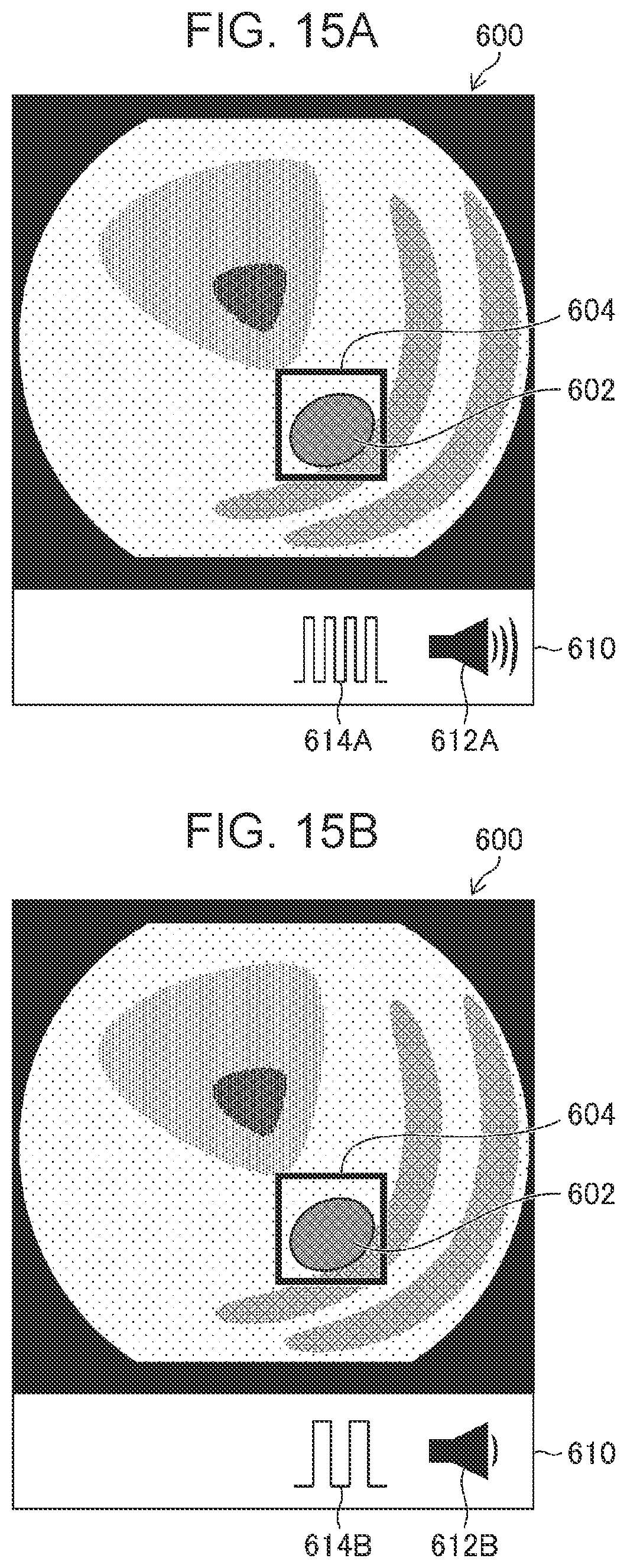 Patent US12588799 Figure 11 – Image diagnosis assistance apparatus, endoscope system, image diagnosis assistance method, and image diagnosis assistance program