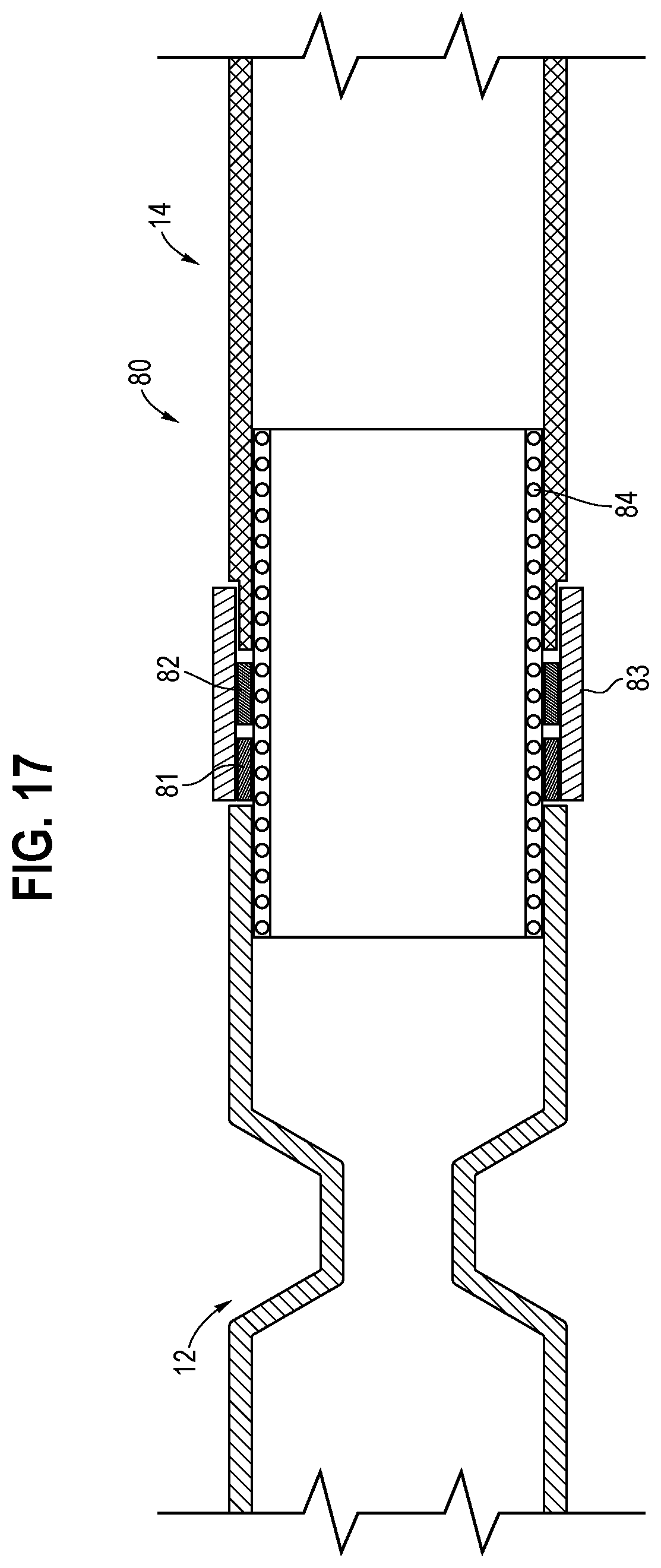 Patent US12588804 Figure 11 – Endoscope bending section