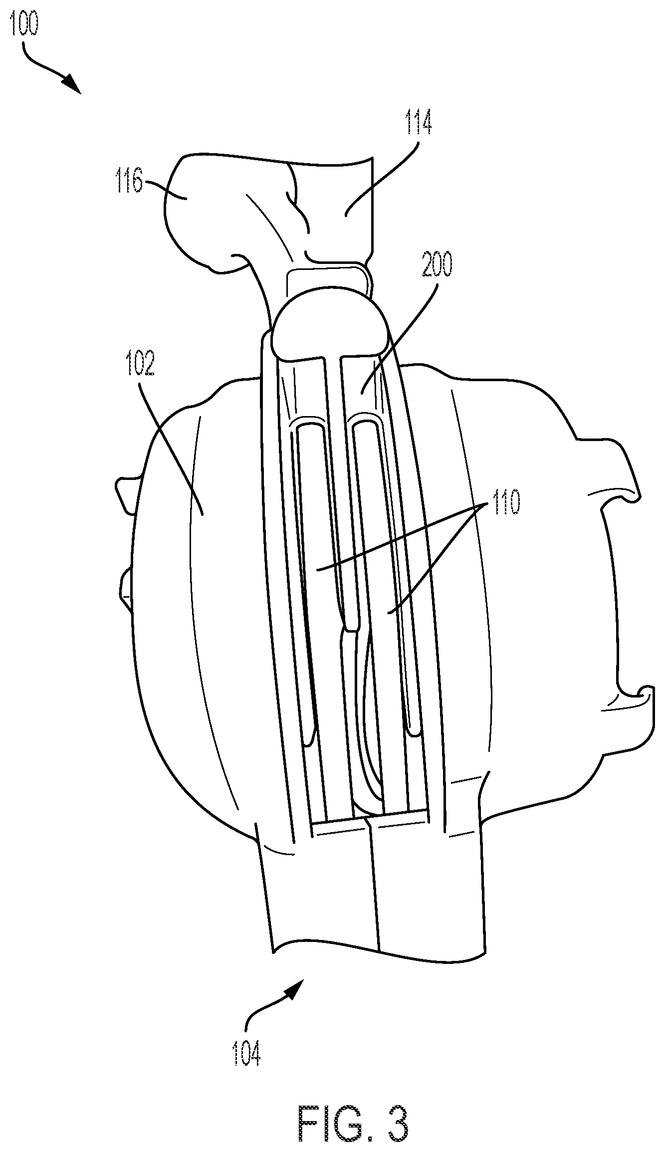 Patent US12588805 Figure 3 – System for telescoping members through an elongate tube