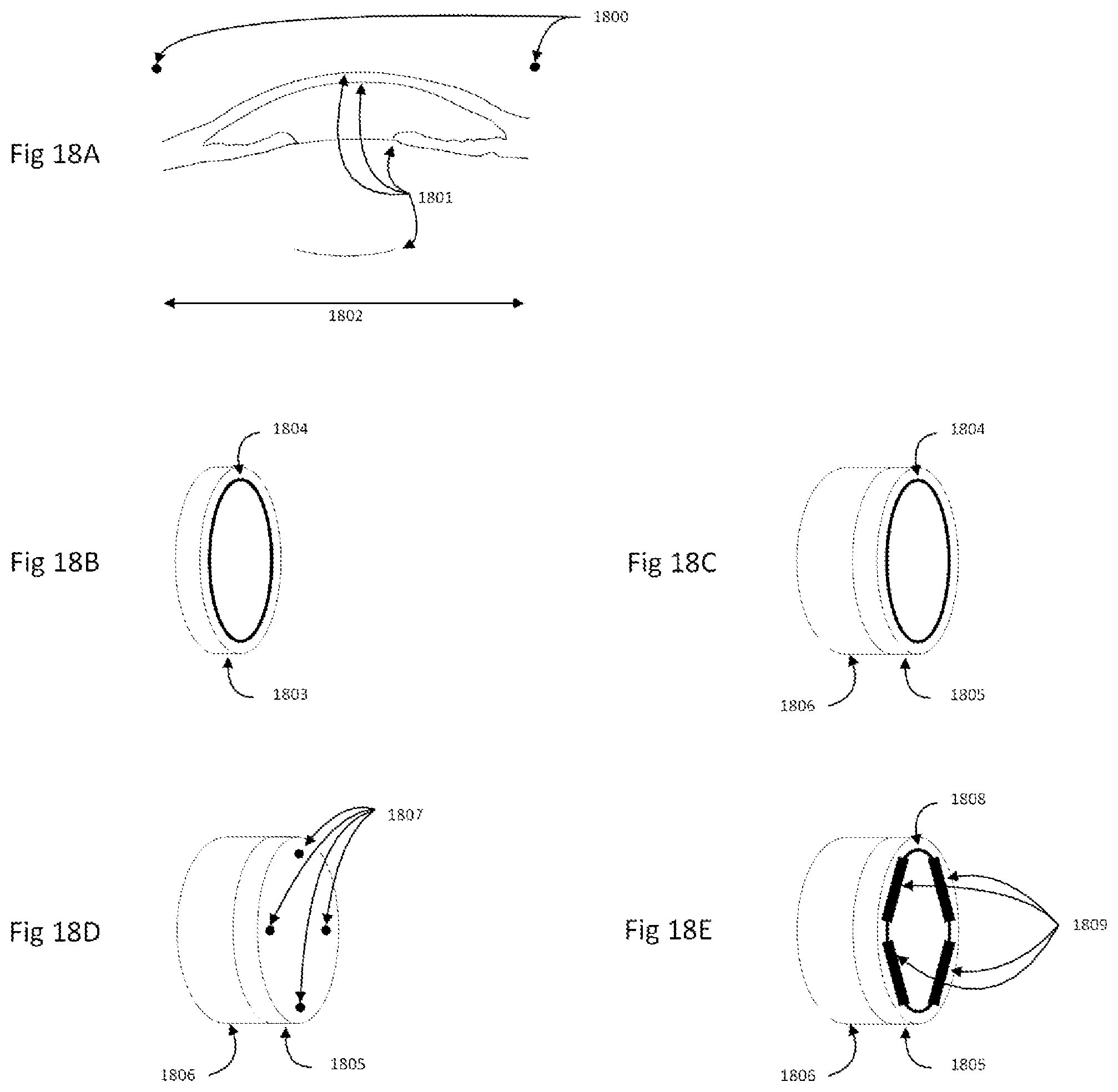 Patent US12588808 Figure 14 – Imaging systems with improved accuracy and measurements