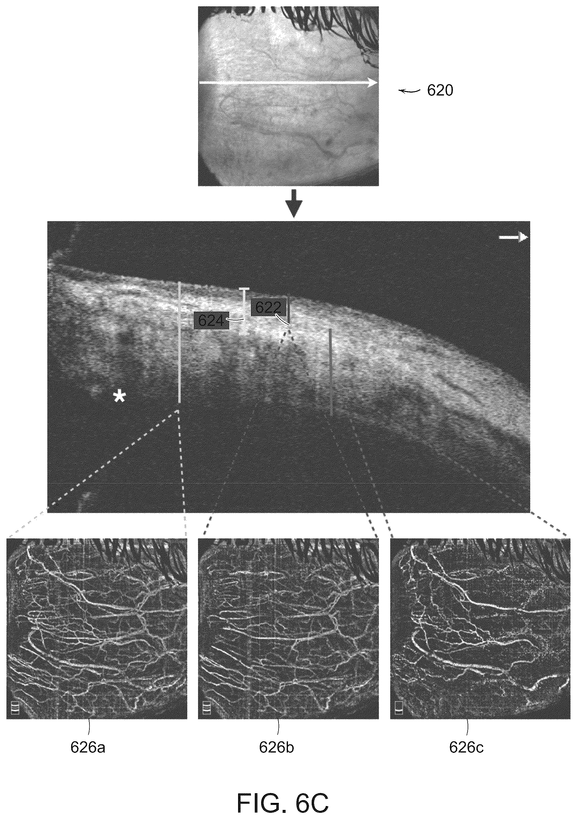 Patent US12588809 Figure 12 – Systems and methods for determining tissue inflammation levels of the eye from blood vessel characteristics