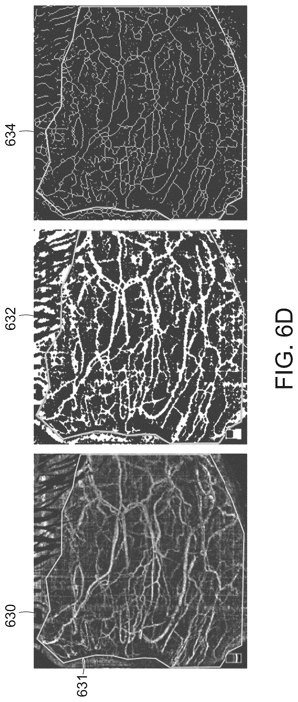 Patent US12588809 Figure 13 – Systems and methods for determining tissue inflammation levels of the eye from blood vessel characteristics