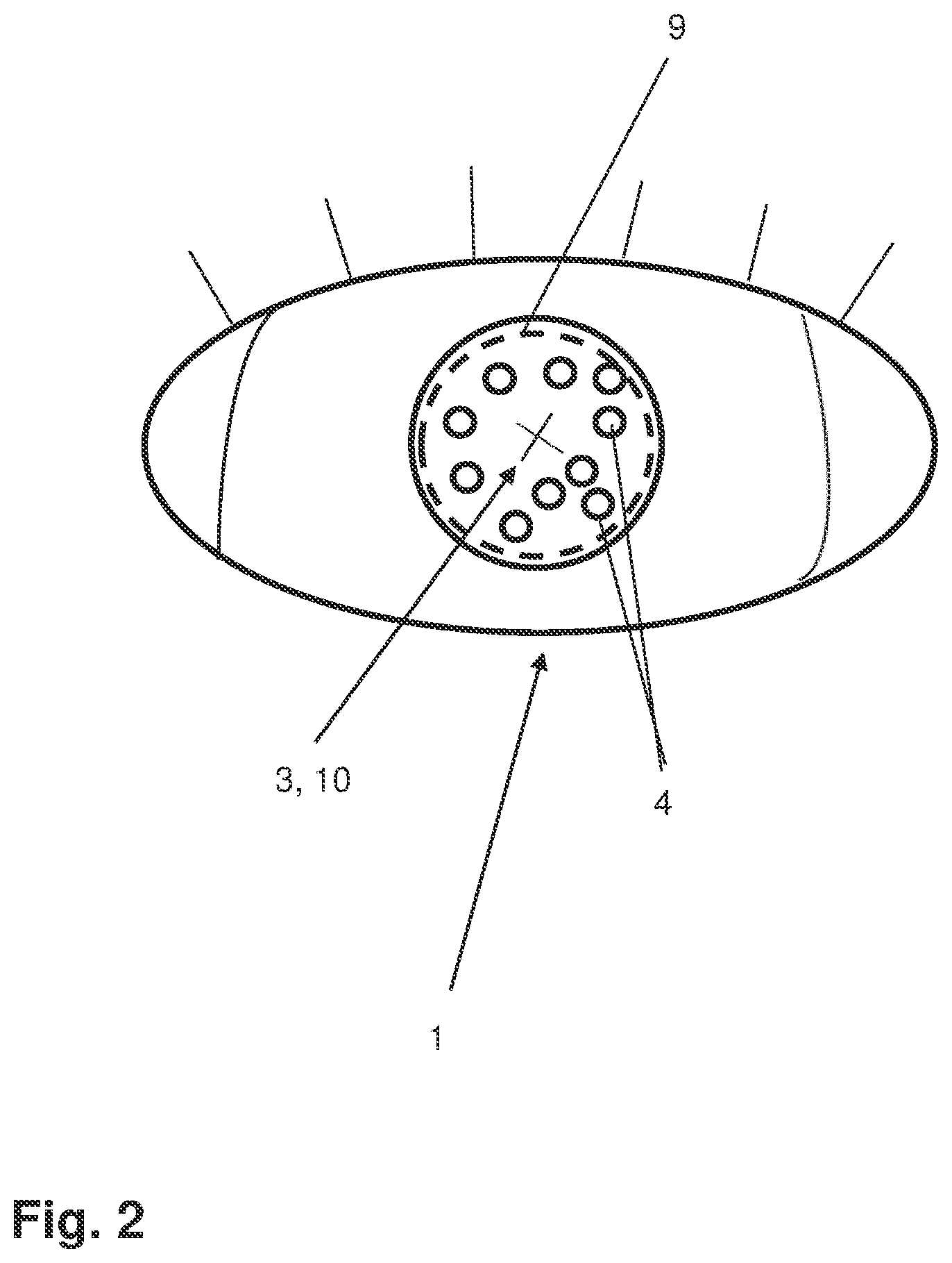 Patent US12588810 Figure 2 – Arrangement and method for determining eye lengths