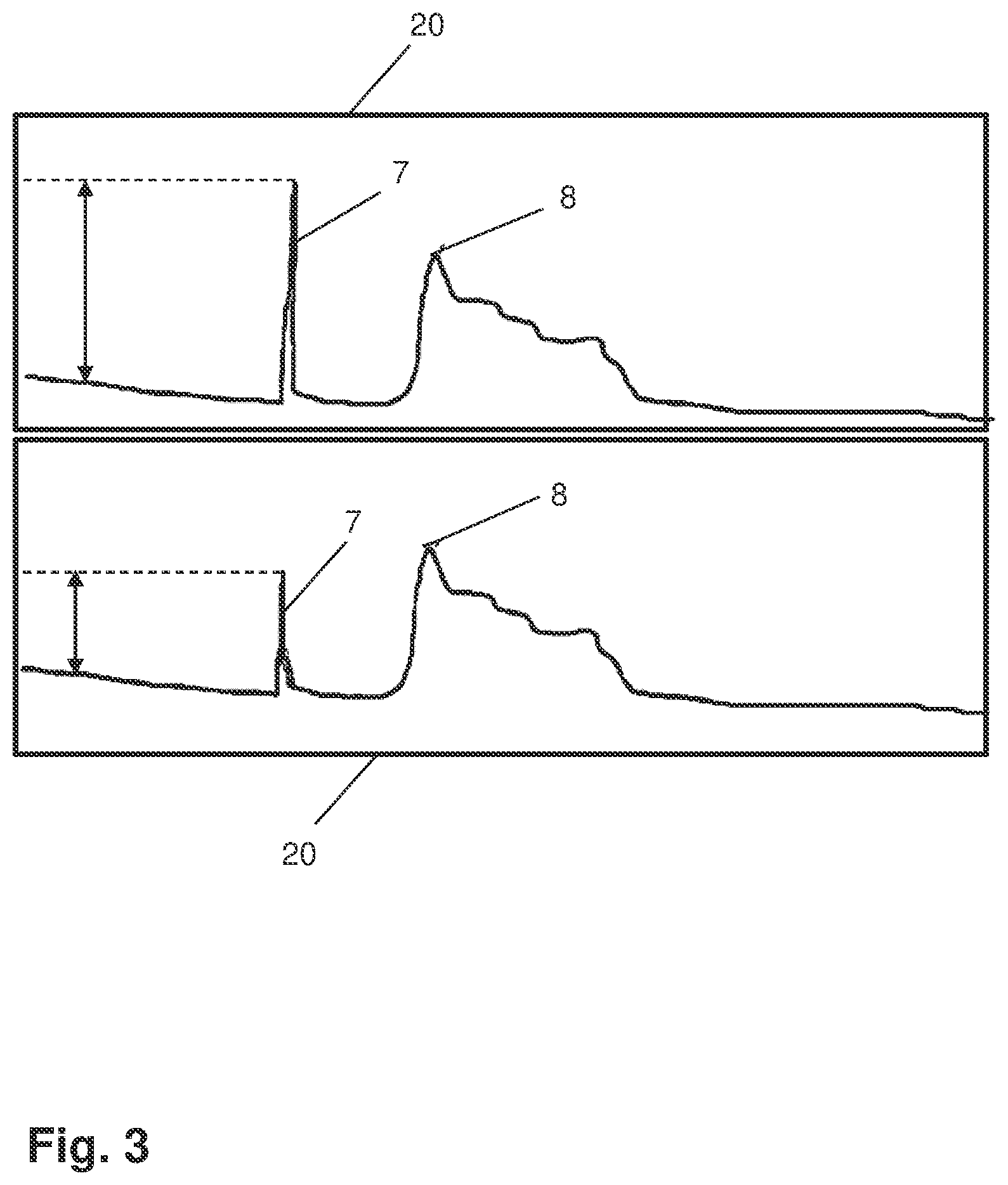 Patent US12588810 Figure 3 – Arrangement and method for determining eye lengths
