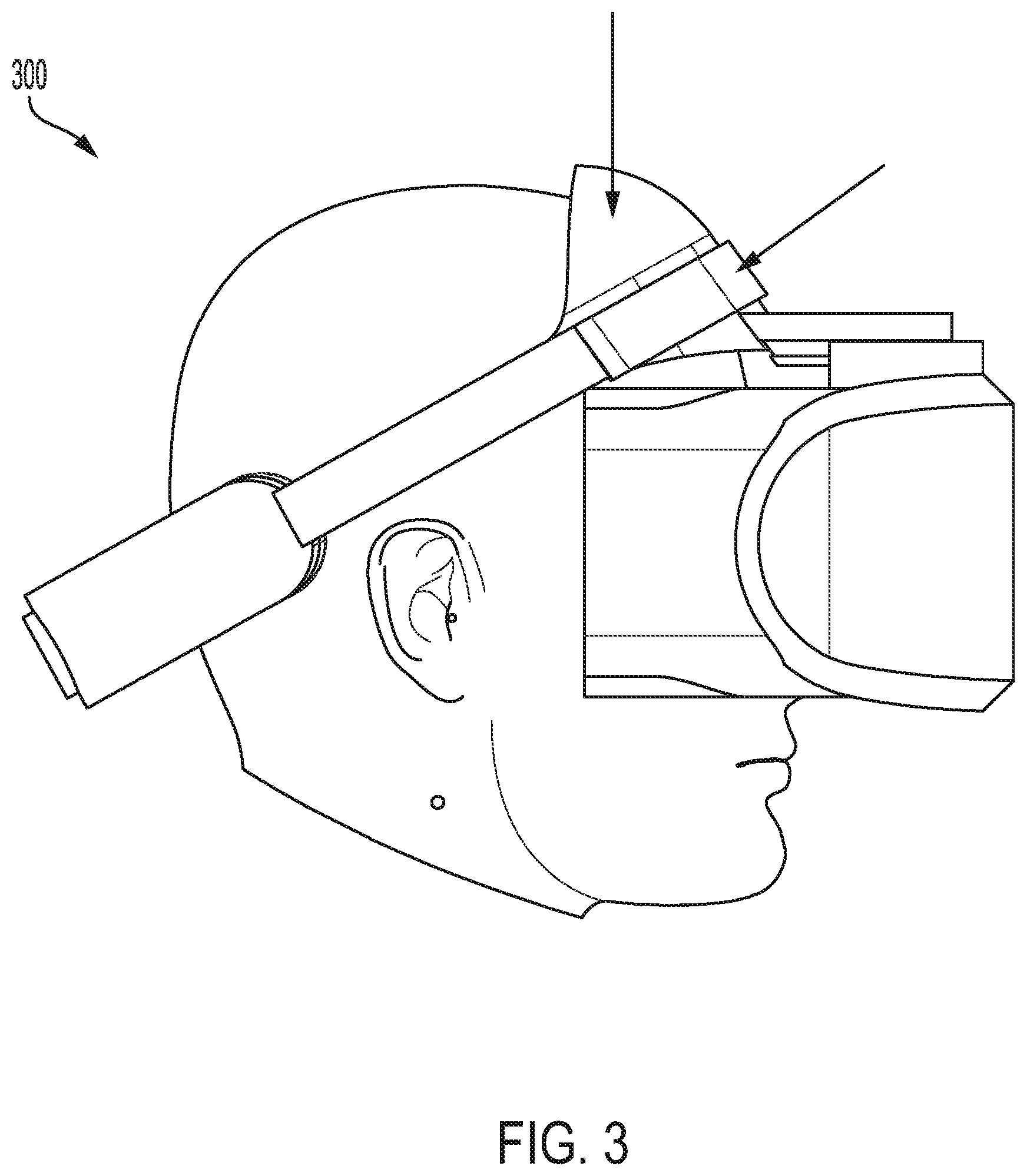 Patent US12588811 Figure 3 – Modular platform for ocular evaluations