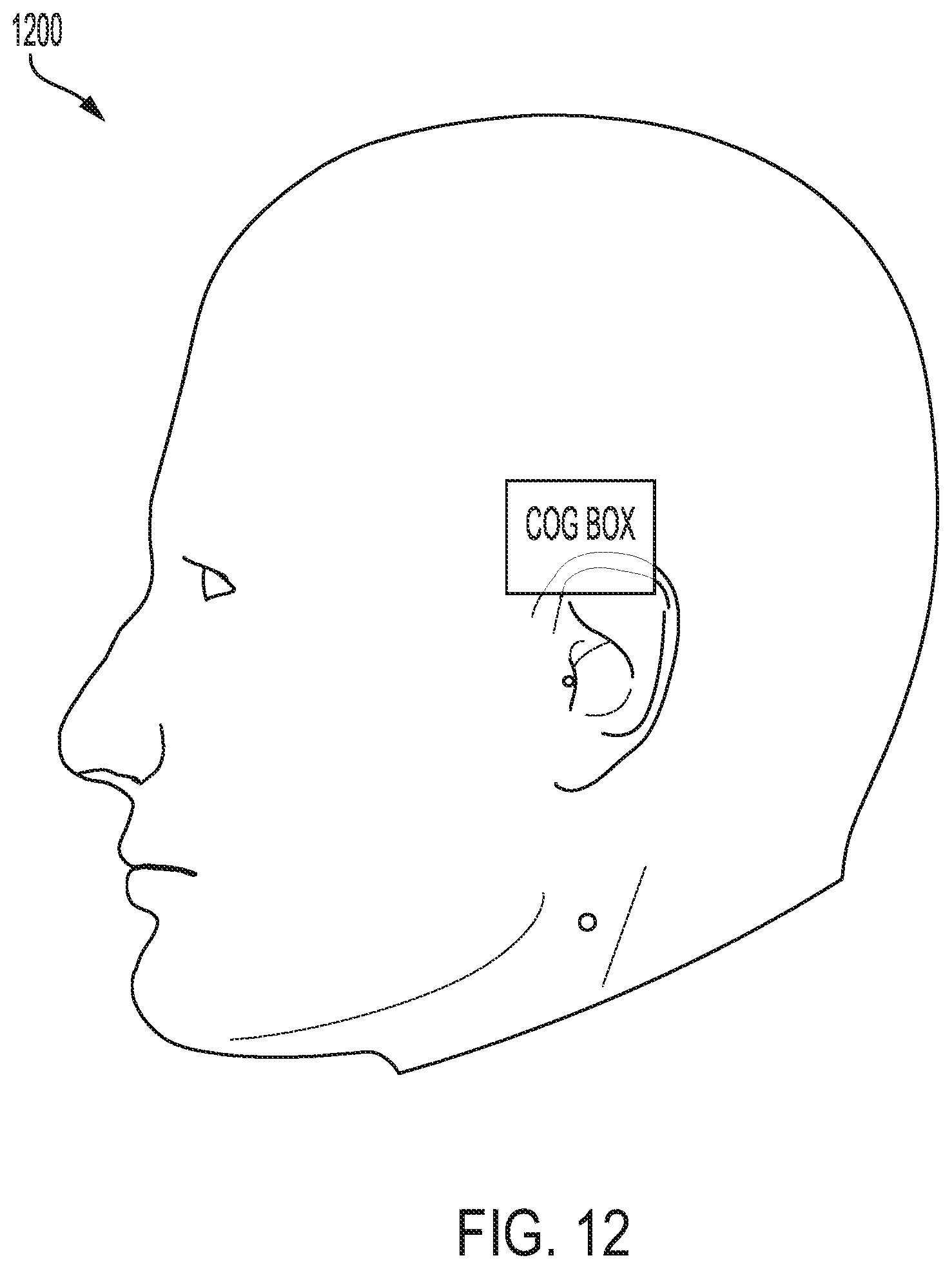 Patent US12588811 Figure 12 – Modular platform for ocular evaluations