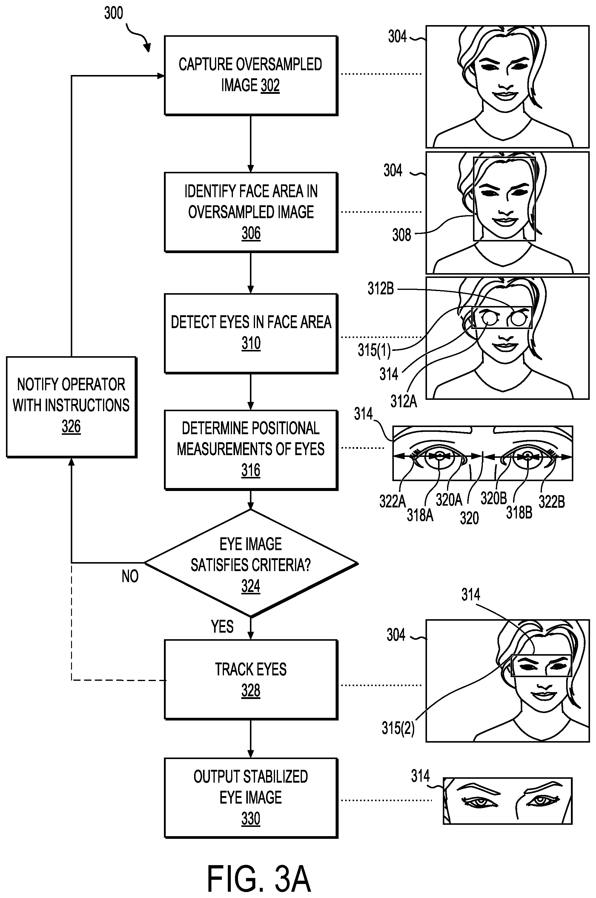 Patent US12588814 Figure 5 – Vision screening device including oversampling sensor