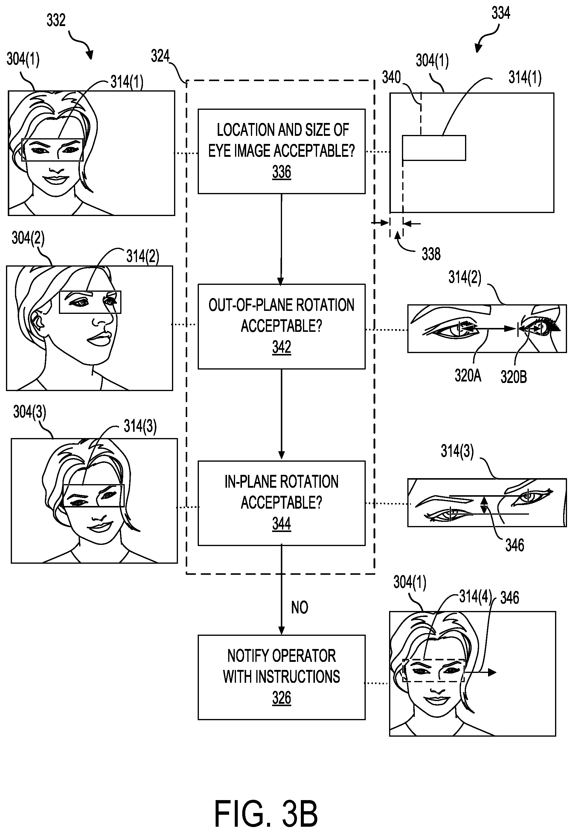 Patent US12588814 Figure 6 – Vision screening device including oversampling sensor