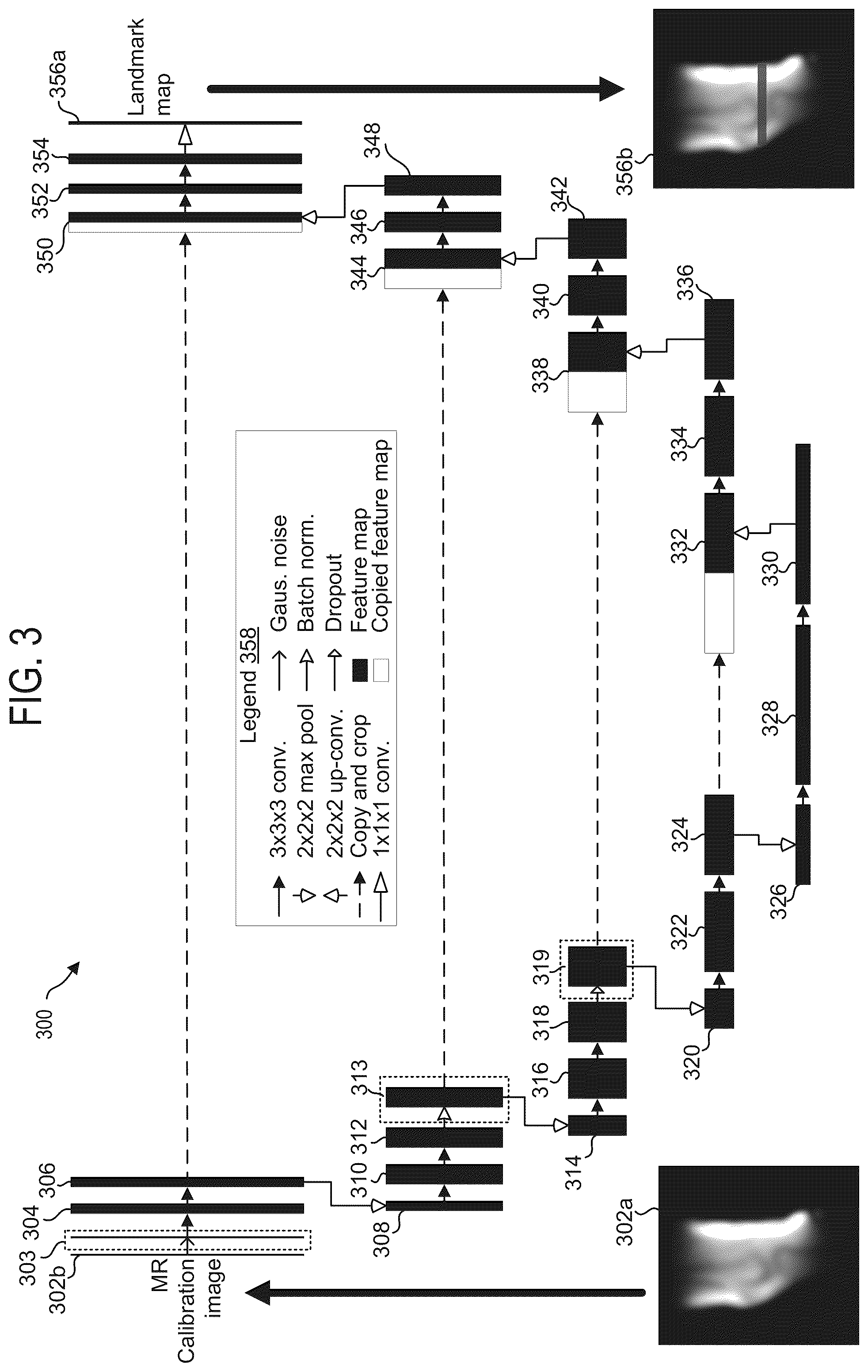 Patent US12588817 Figure 3 – Systems and methods for generating diagnostic scan parameters from calibration images
