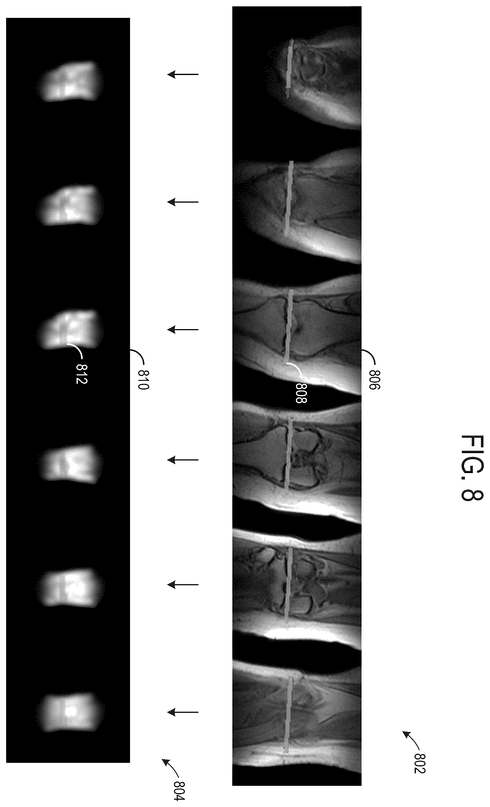 Patent US12588817 Figure 8 – Systems and methods for generating diagnostic scan parameters from calibration images