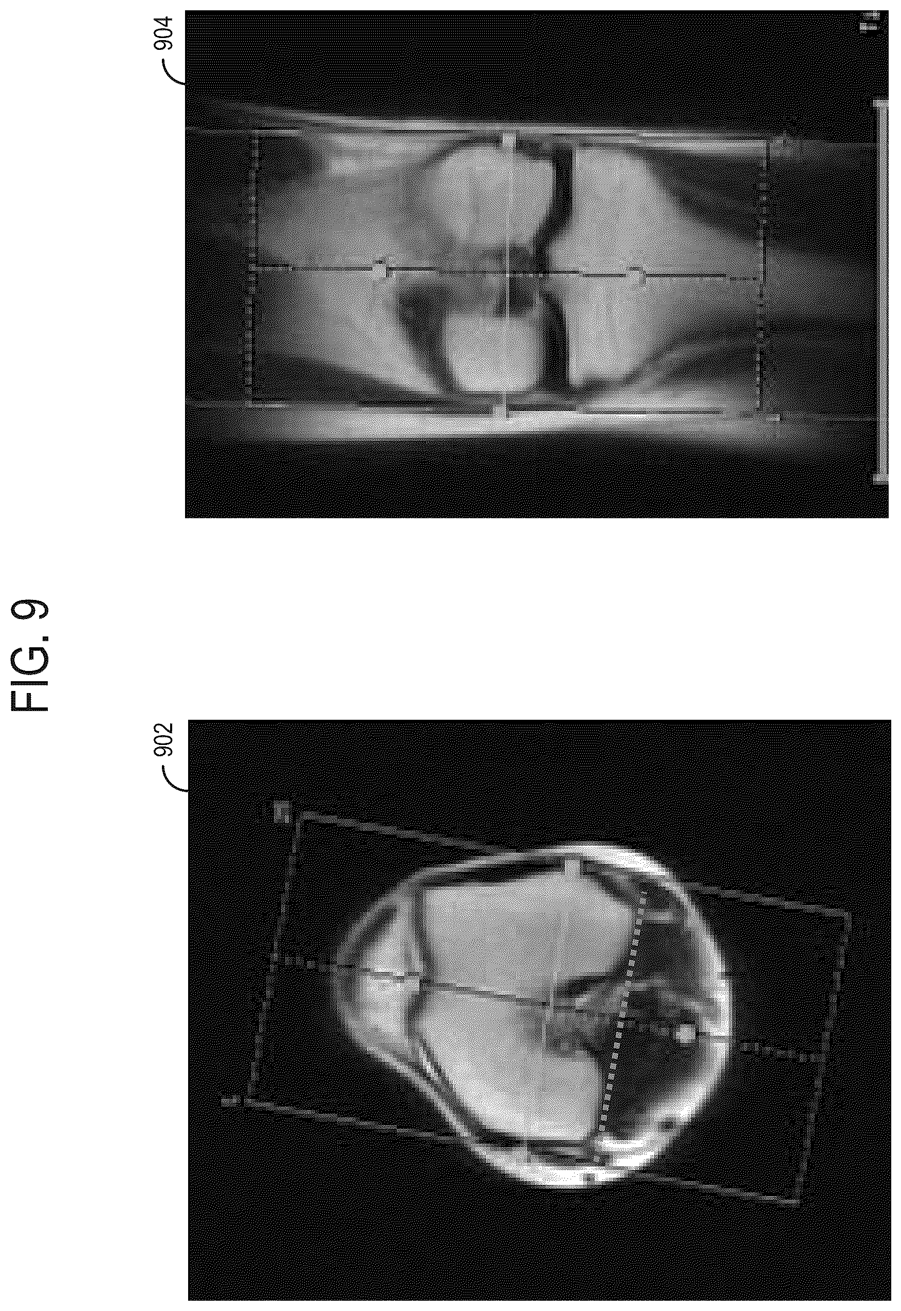 Patent US12588817 Figure 9 – Systems and methods for generating diagnostic scan parameters from calibration images