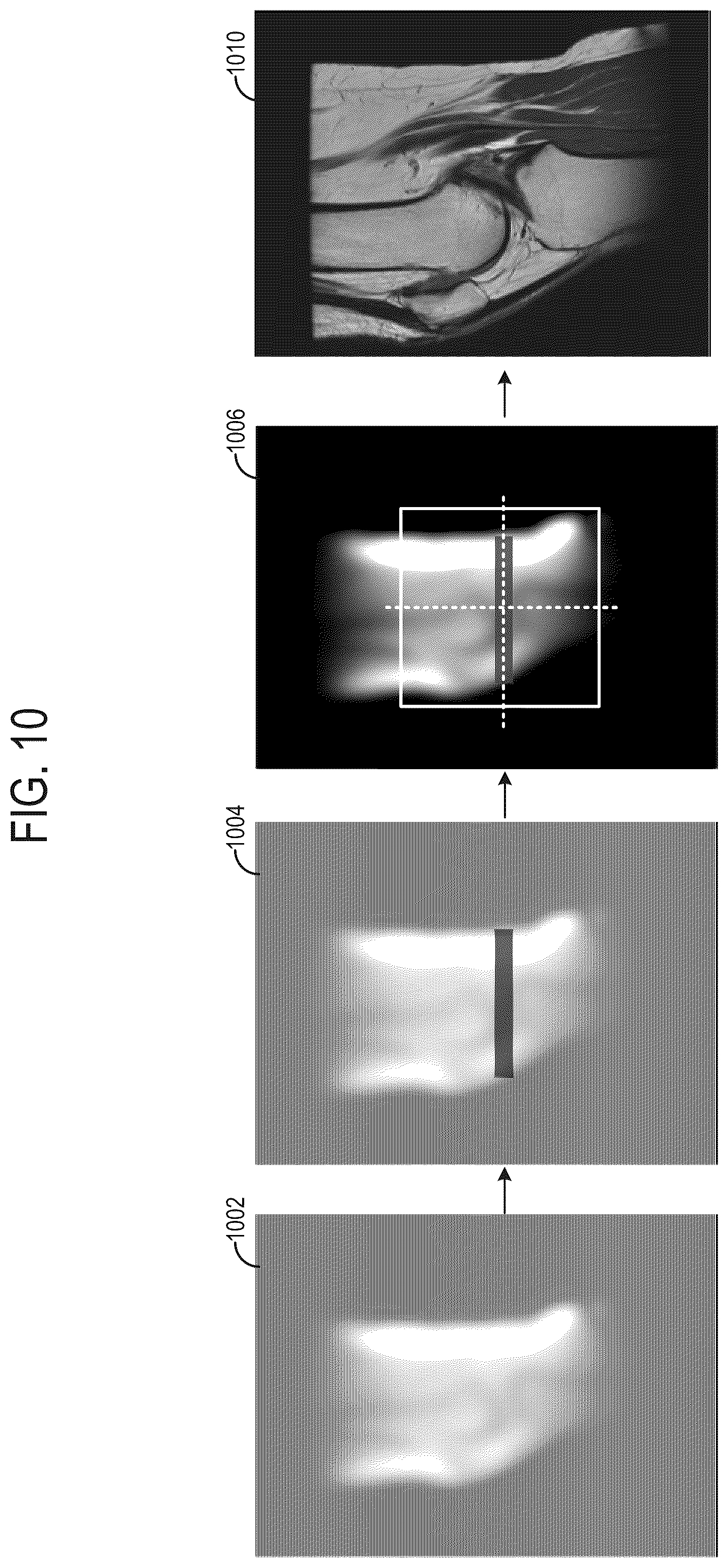 Patent US12588817 Figure 10 – Systems and methods for generating diagnostic scan parameters from calibration images