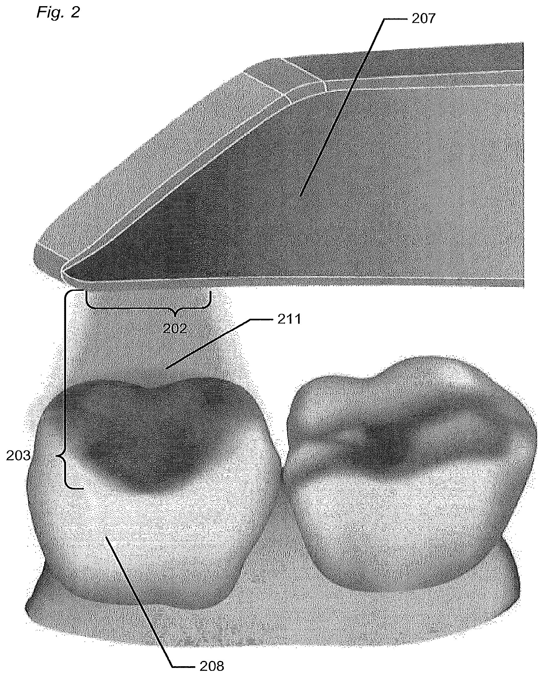 Patent US12588818 Figure 2 – Detection of a movable object when 3D scanning a rigid object