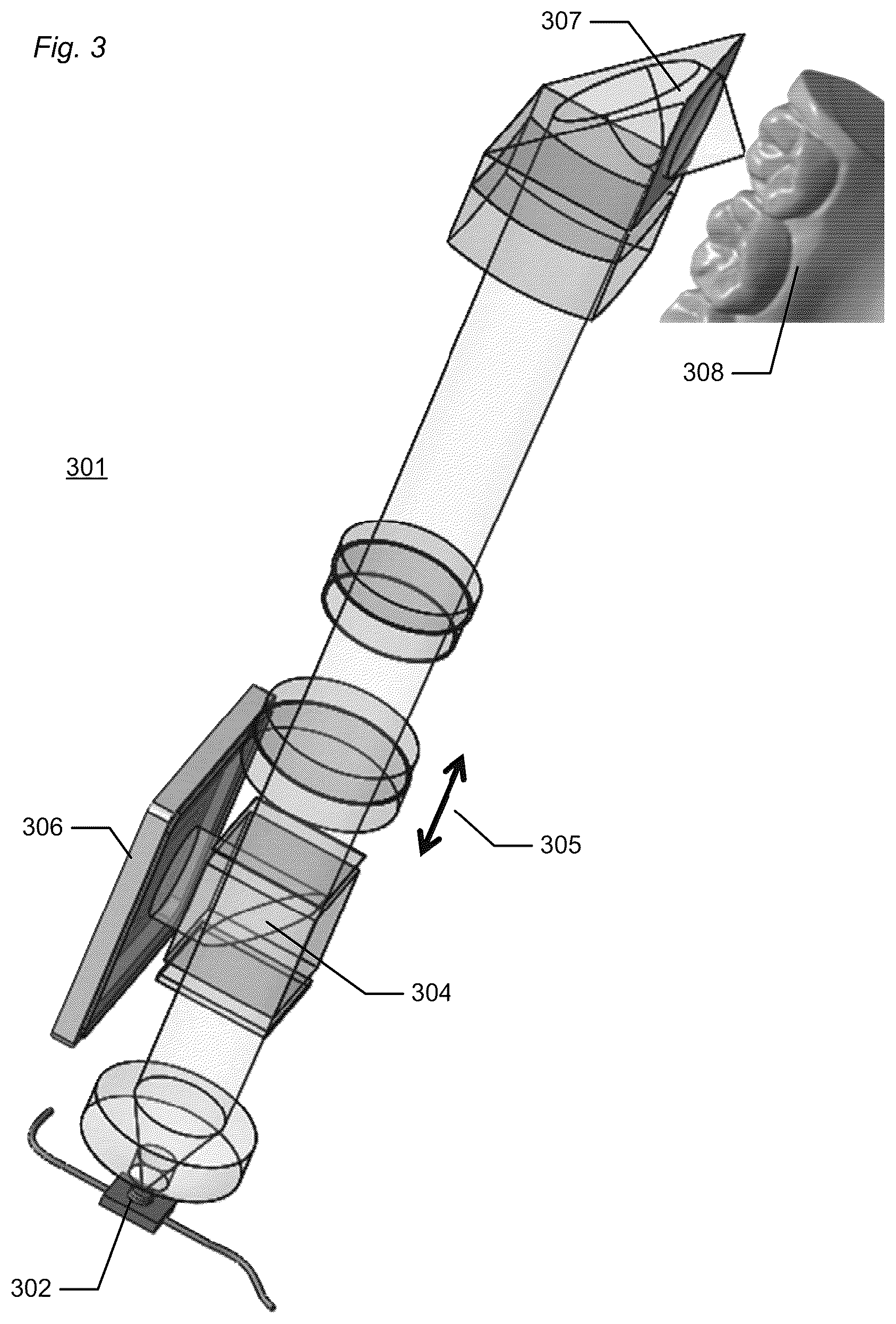 Patent US12588818 Figure 3 – Detection of a movable object when 3D scanning a rigid object