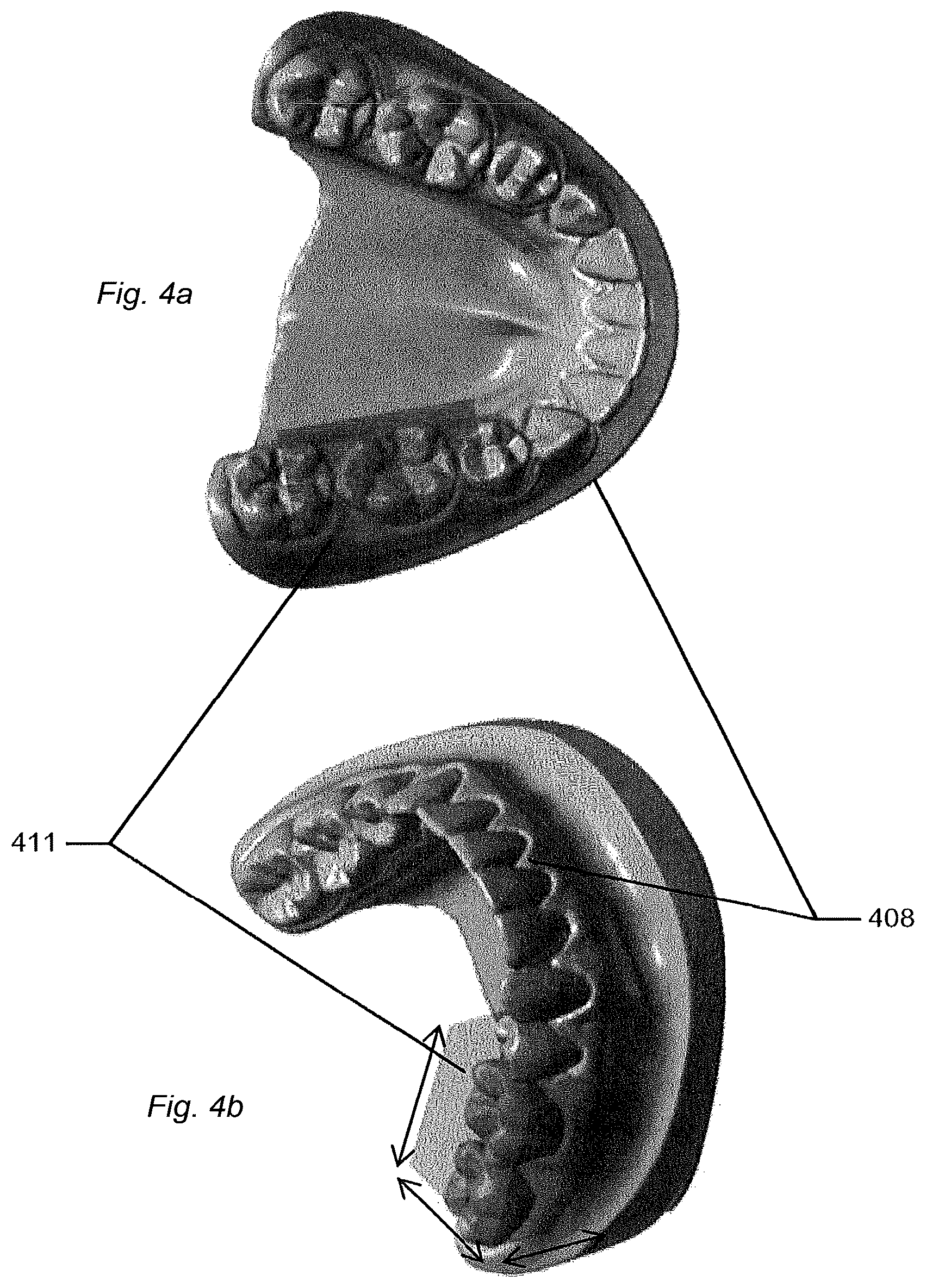 Patent US12588818 Figure 4 – Detection of a movable object when 3D scanning a rigid object