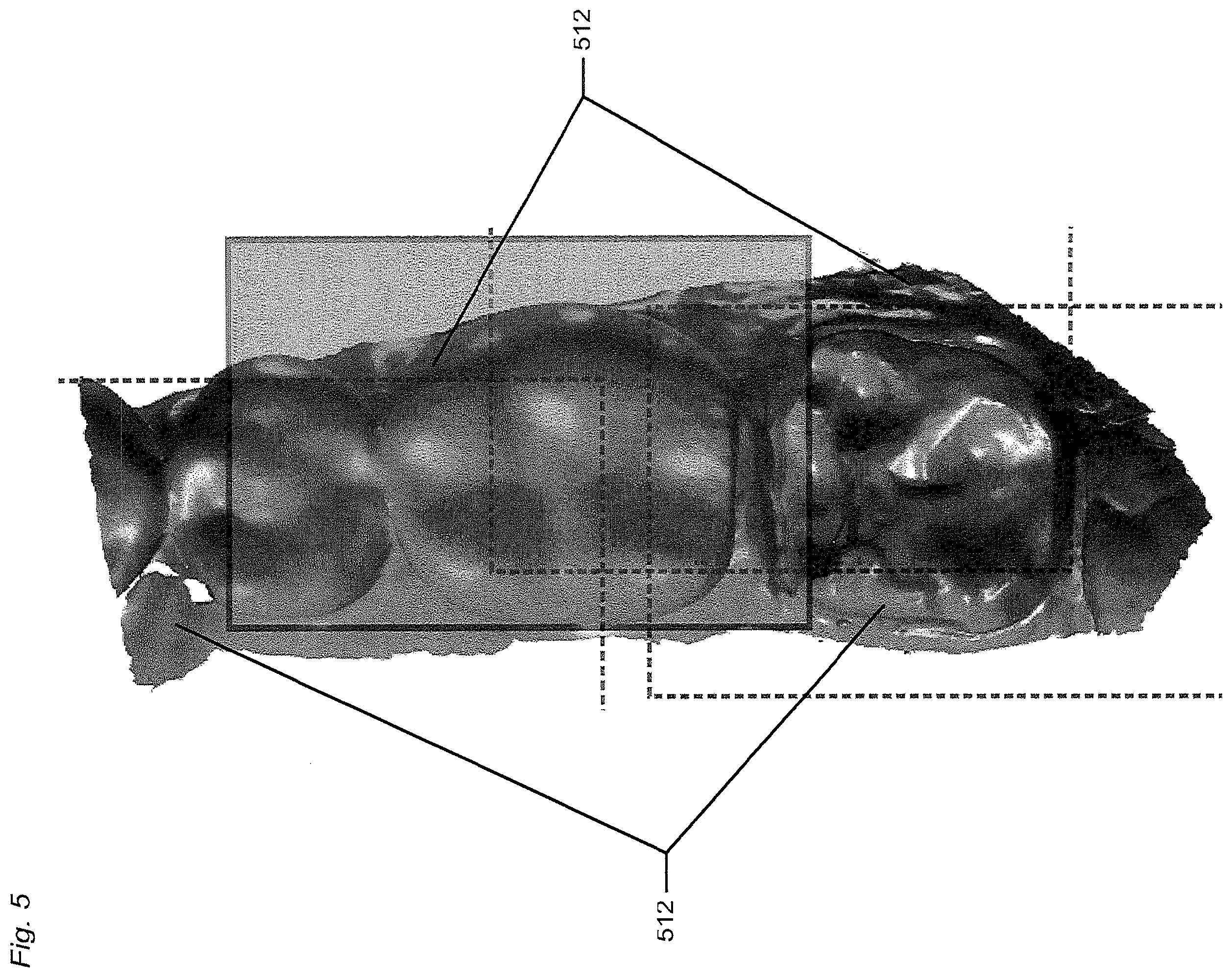 Patent US12588818 Figure 5 – Detection of a movable object when 3D scanning a rigid object