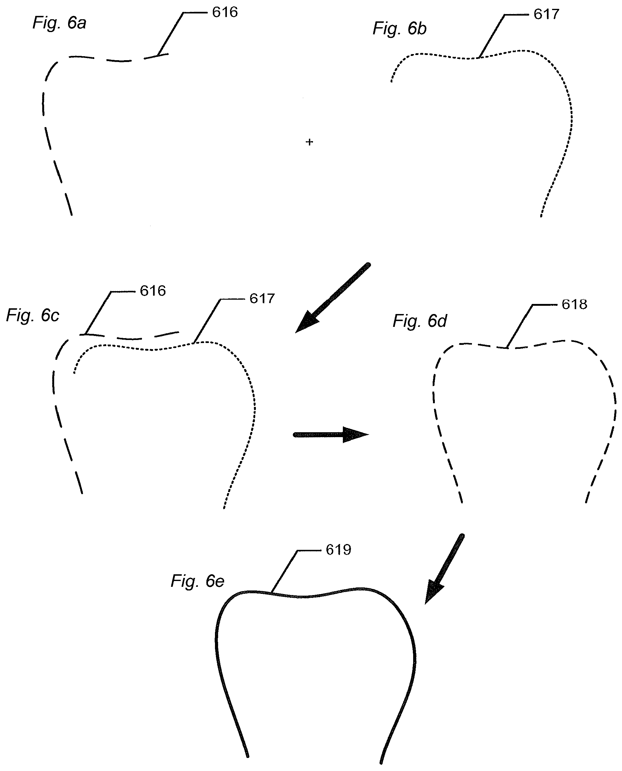 Patent US12588818 Figure 6 – Detection of a movable object when 3D scanning a rigid object