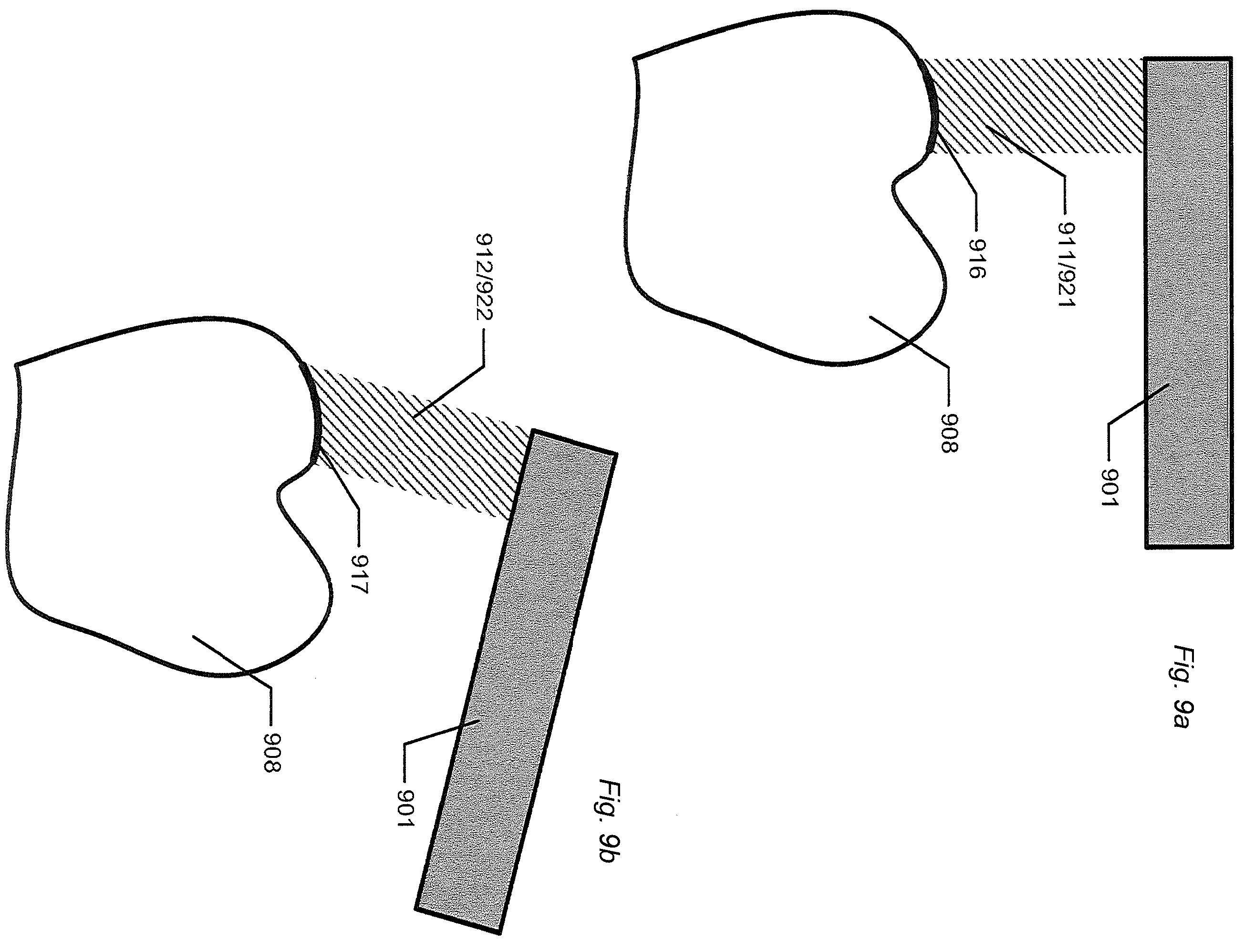 Patent US12588818 Figure 8 – Detection of a movable object when 3D scanning a rigid object