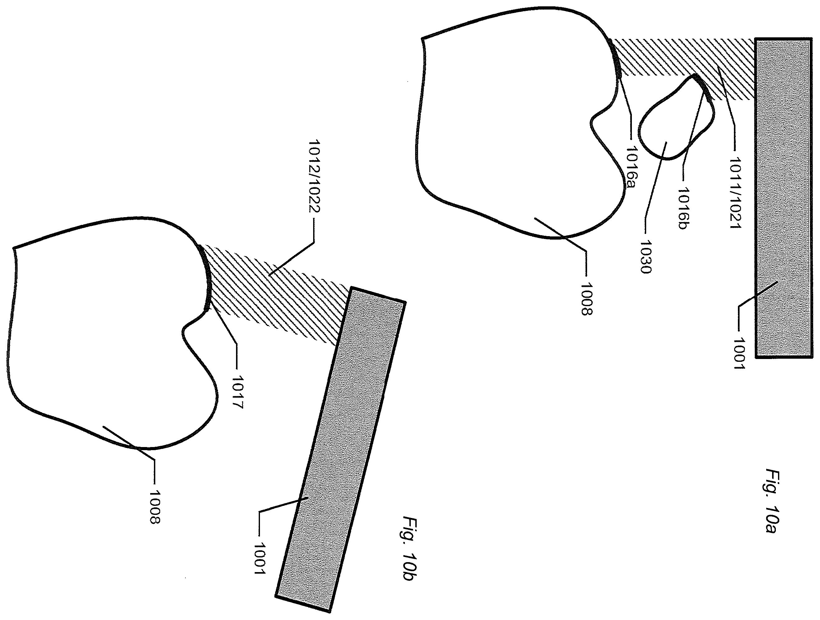Patent US12588818 Figure 9 – Detection of a movable object when 3D scanning a rigid object