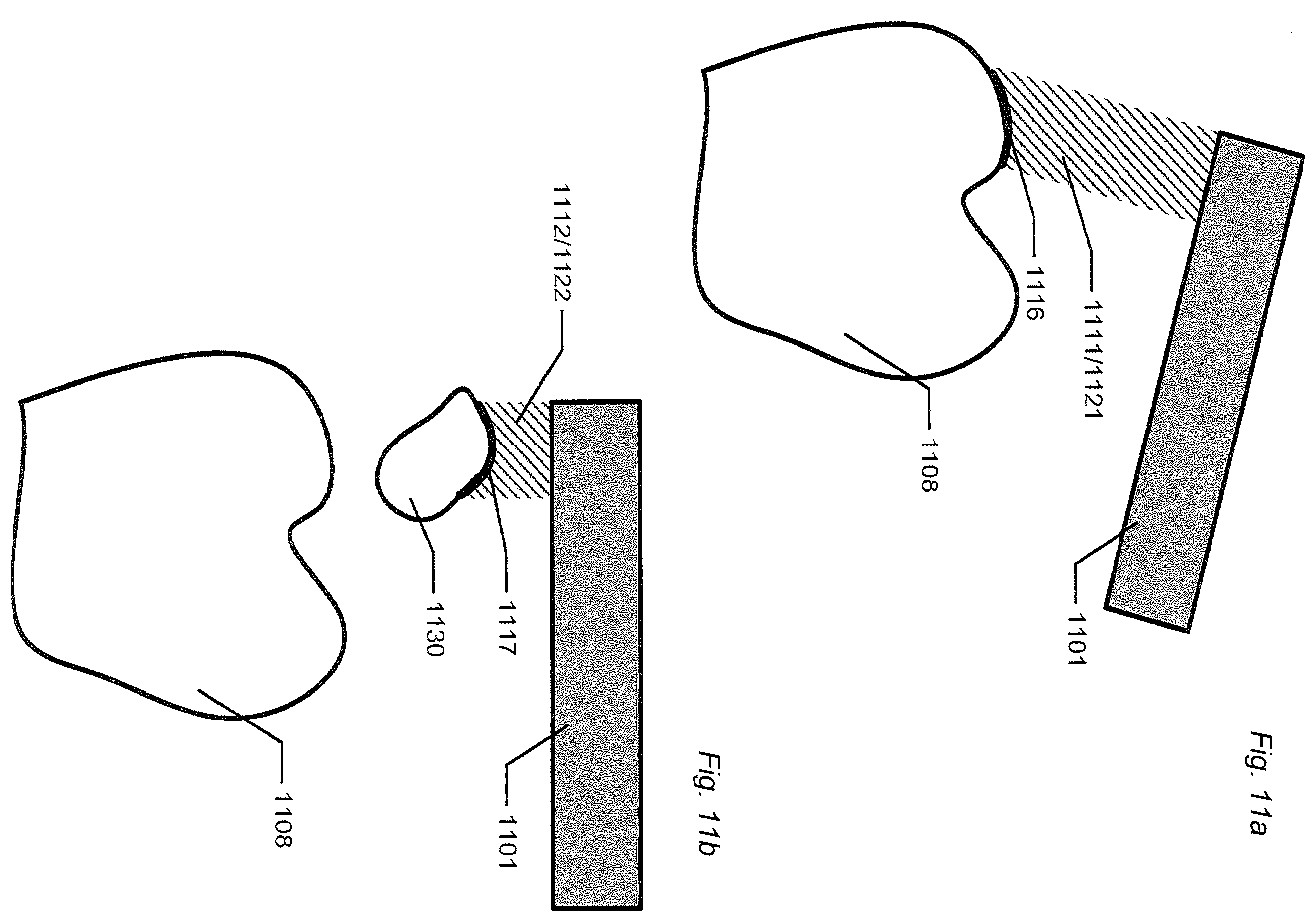 Patent US12588818 Figure 10 – Detection of a movable object when 3D scanning a rigid object