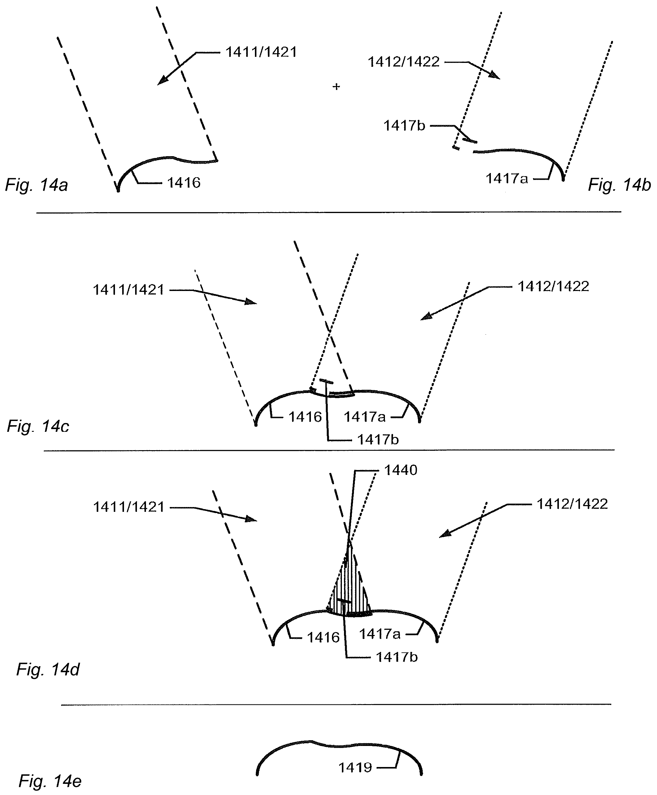 Patent US12588818 Figure 13 – Detection of a movable object when 3D scanning a rigid object