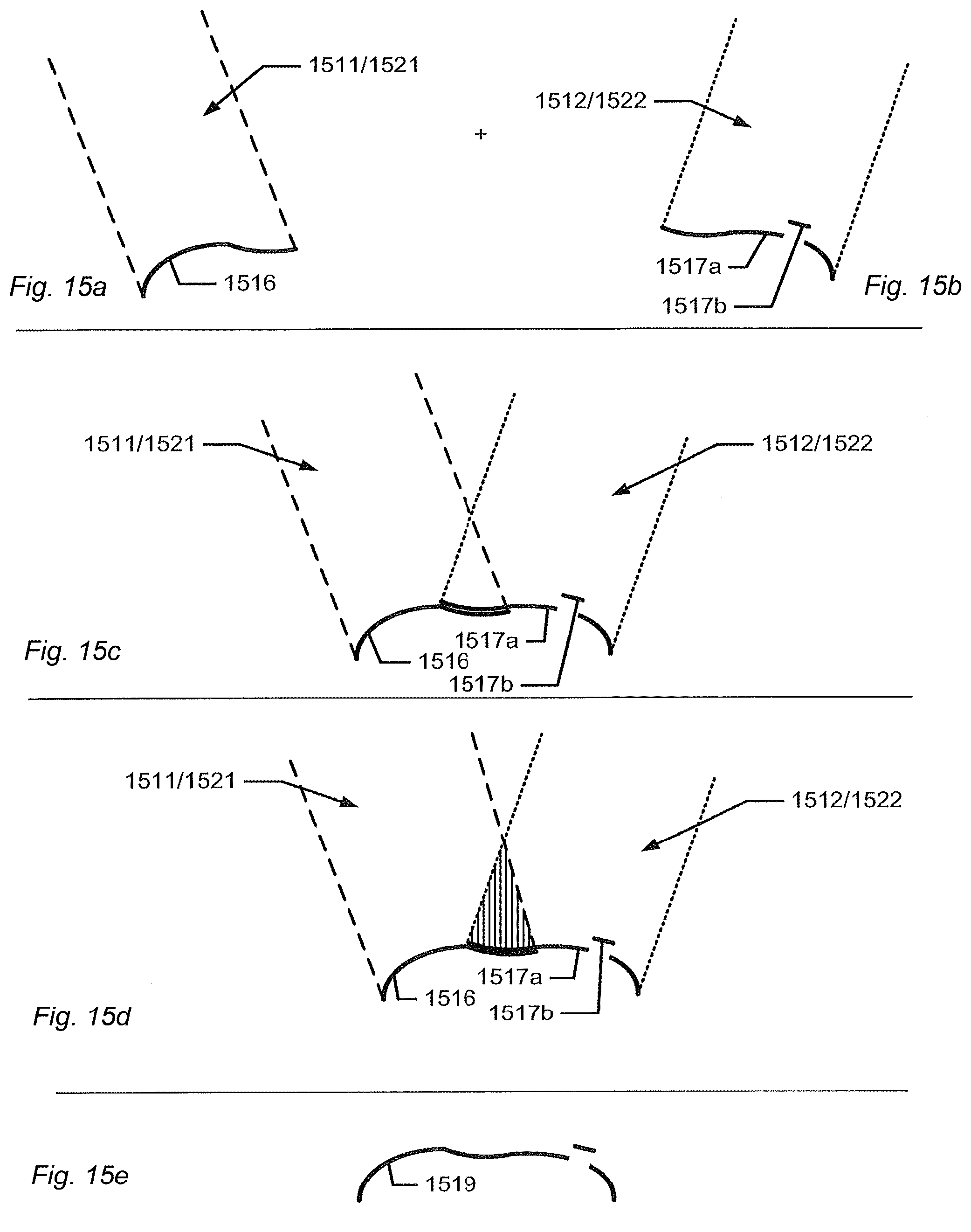 Patent US12588818 Figure 14 – Detection of a movable object when 3D scanning a rigid object