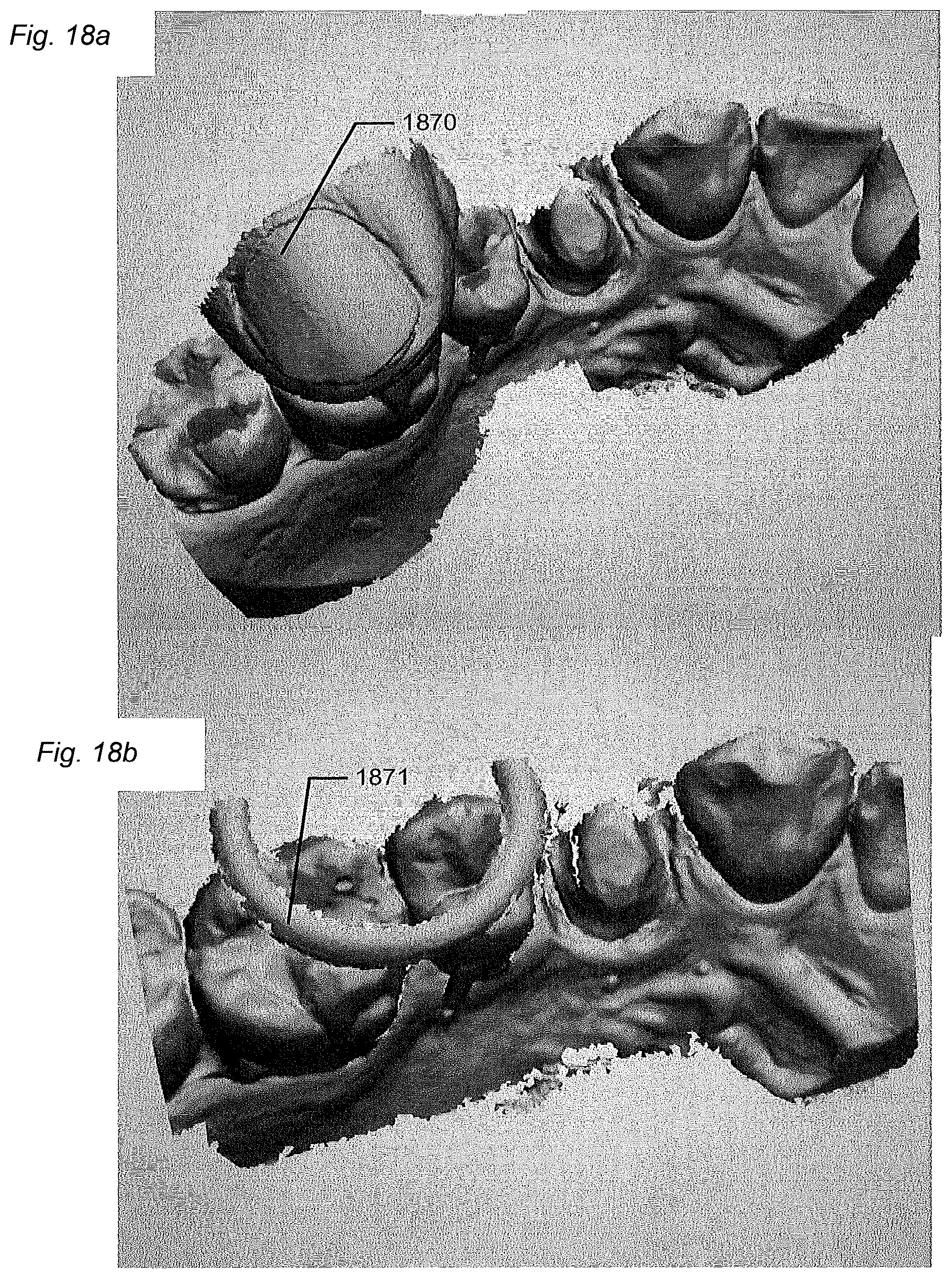 Patent US12588818 Figure 16 – Detection of a movable object when 3D scanning a rigid object