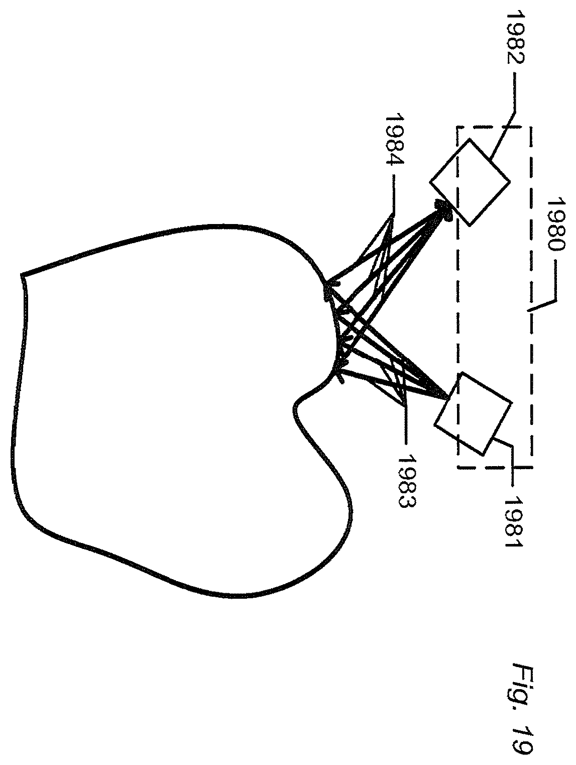 Patent US12588818 Figure 17 – Detection of a movable object when 3D scanning a rigid object