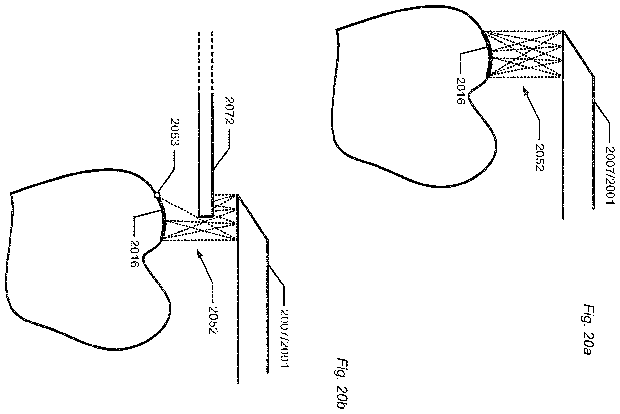 Patent US12588818 Figure 18 – Detection of a movable object when 3D scanning a rigid object
