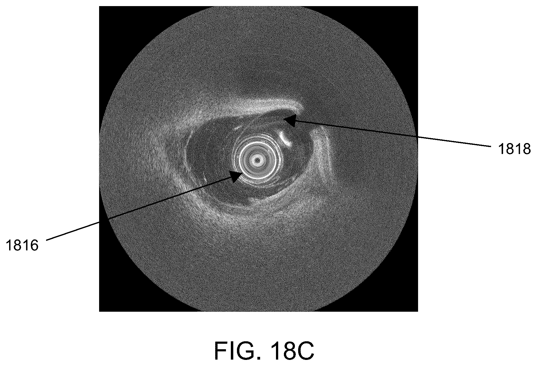 Patent US12588819 Figure 19 – Oct catheter with low refractive index optical material