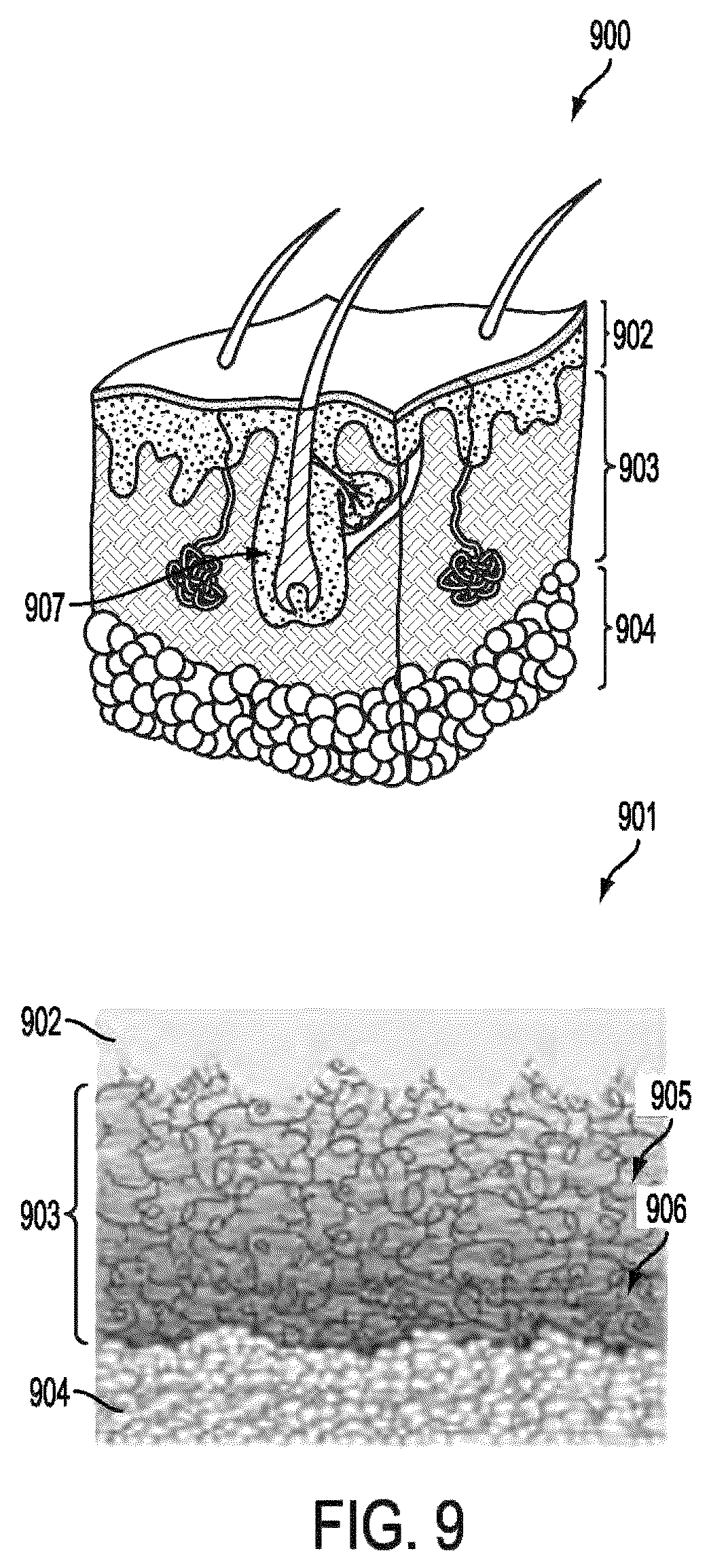 Patent US12588820 Figure 14 – Wearable device for differential measurement on pulse rate and blood flow