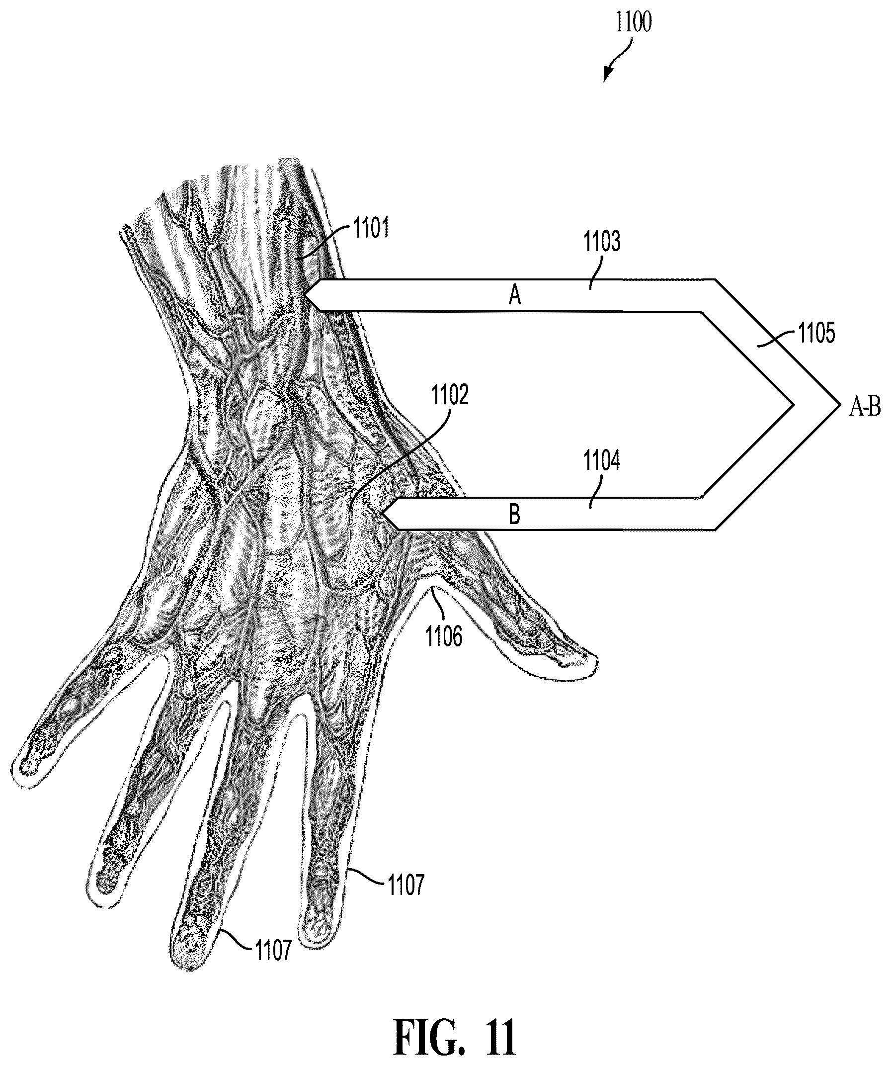 Patent US12588820 Figure 16 – Wearable device for differential measurement on pulse rate and blood flow