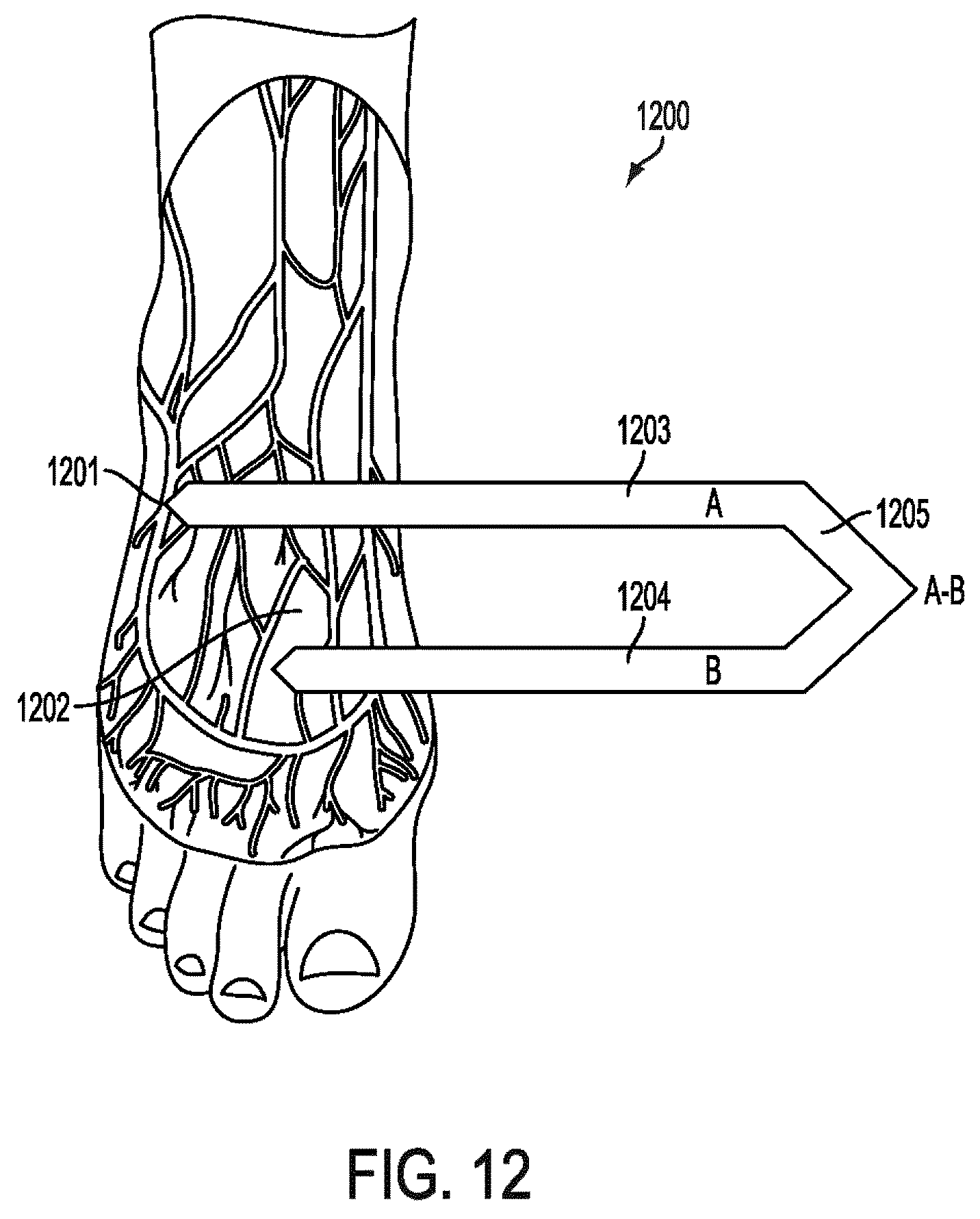 Patent US12588820 Figure 17 – Wearable device for differential measurement on pulse rate and blood flow