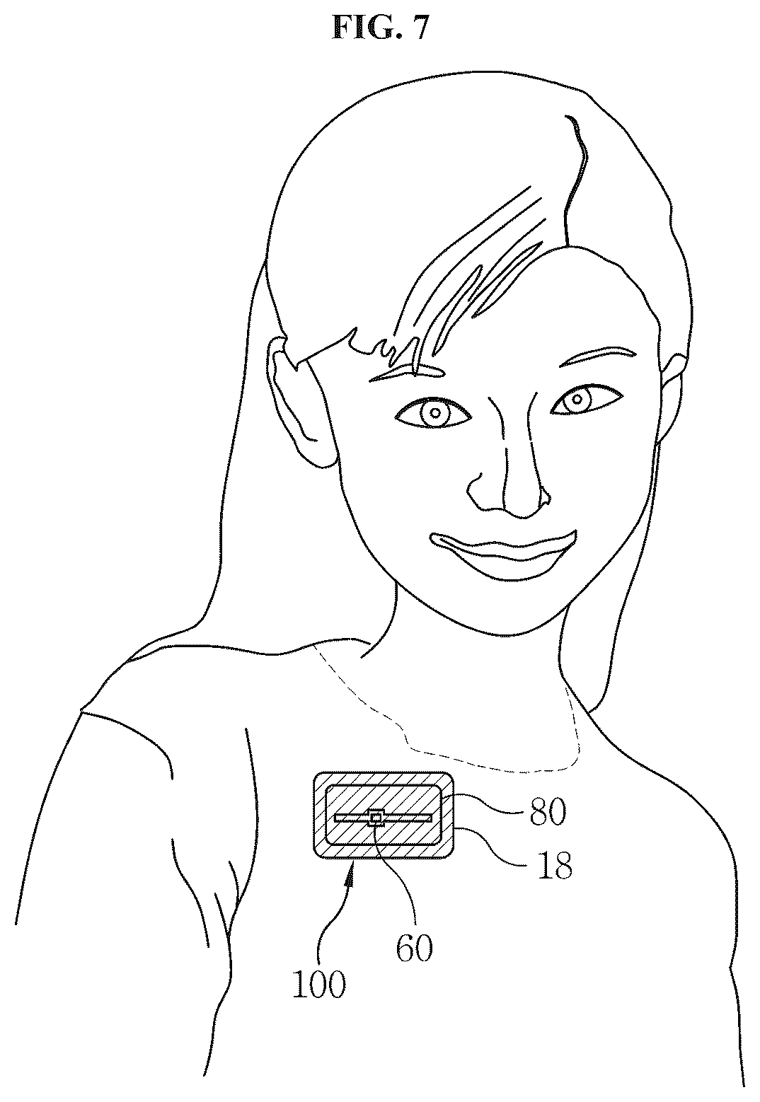 Patent US12588821 Figure 4 – Body temperature estimation system and method based on one-channel temperature sensor