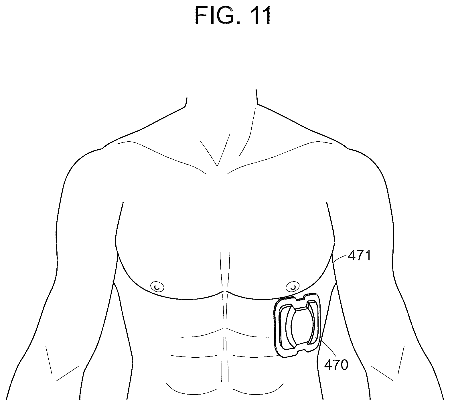 Patent US12588822 Figure 12 – Remote physiological monitor
