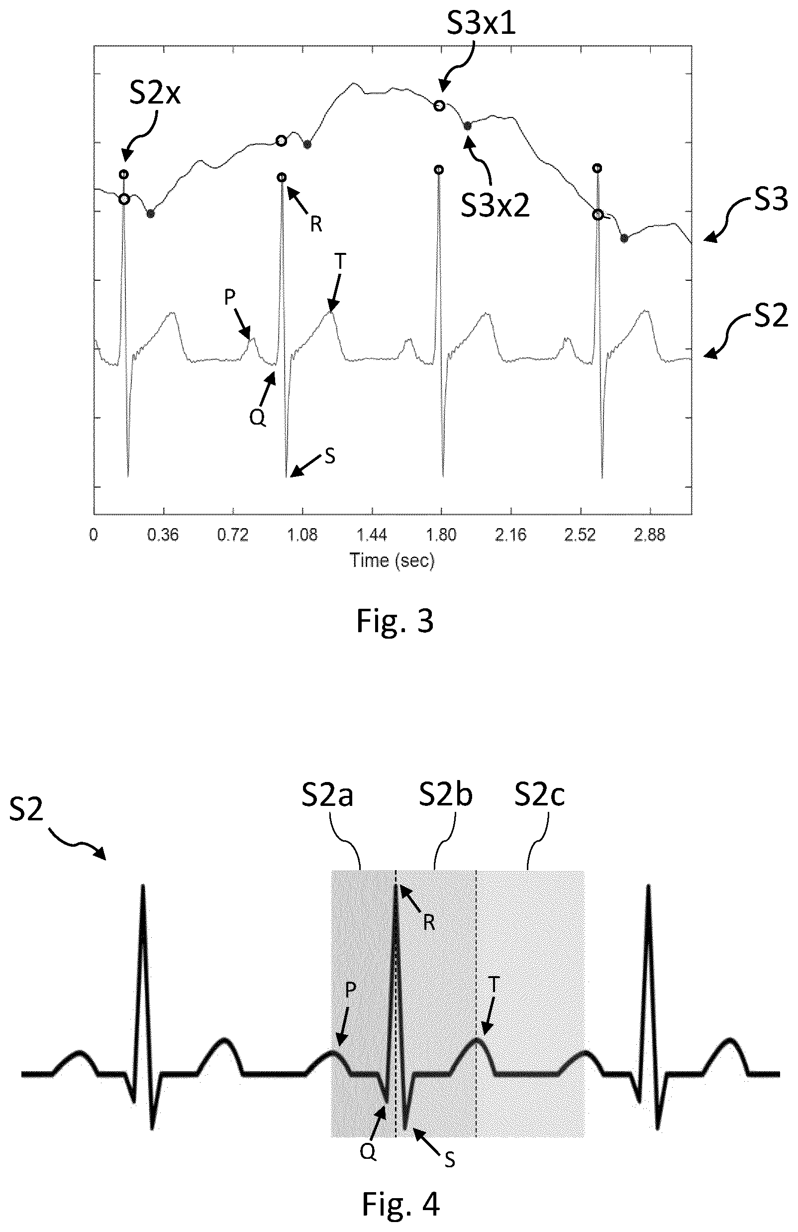 Patent US12588824 Figure 2 – Cardiac pulse wave retrieval from an electrical signal