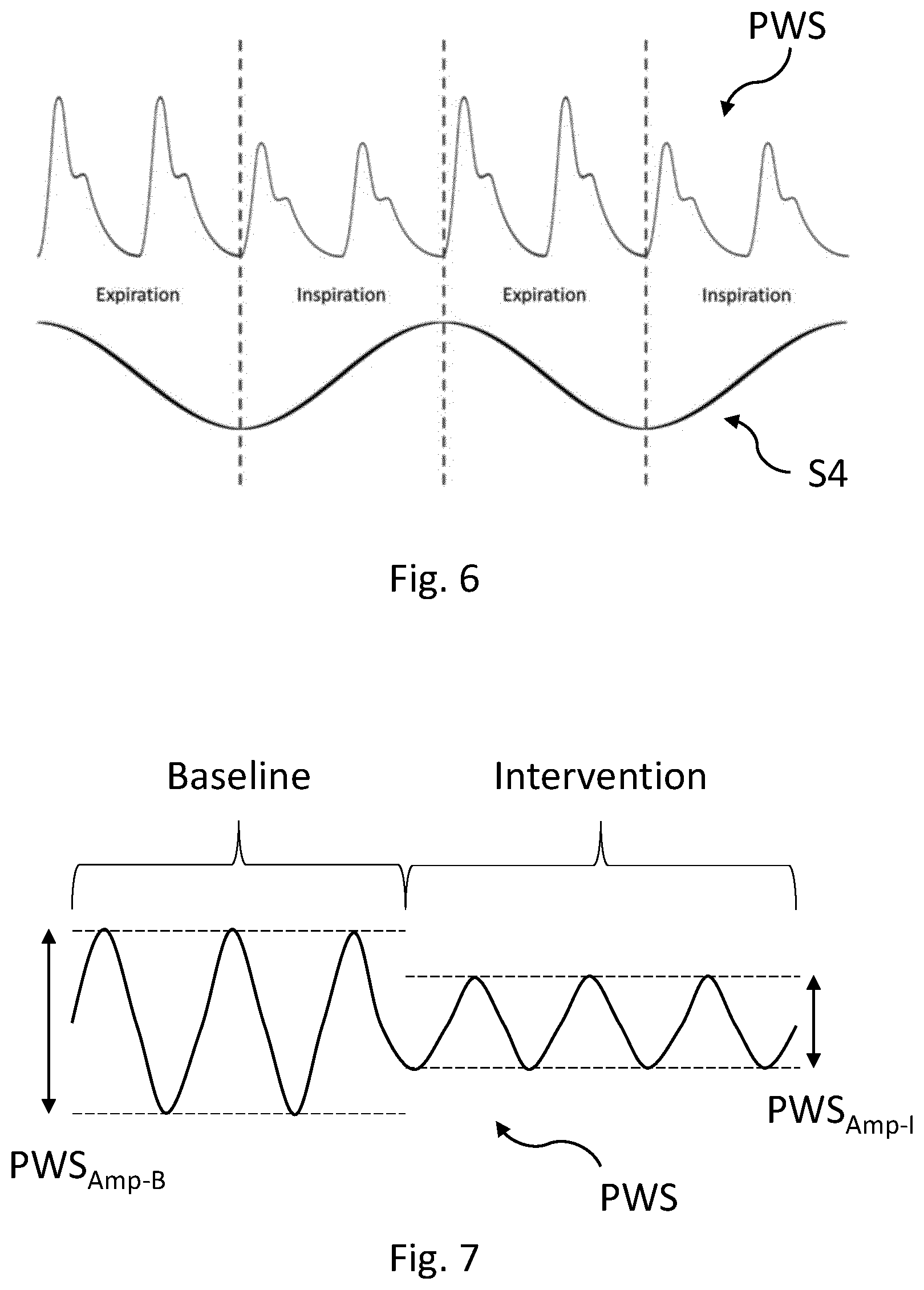 Patent US12588824 Figure 4 – Cardiac pulse wave retrieval from an electrical signal