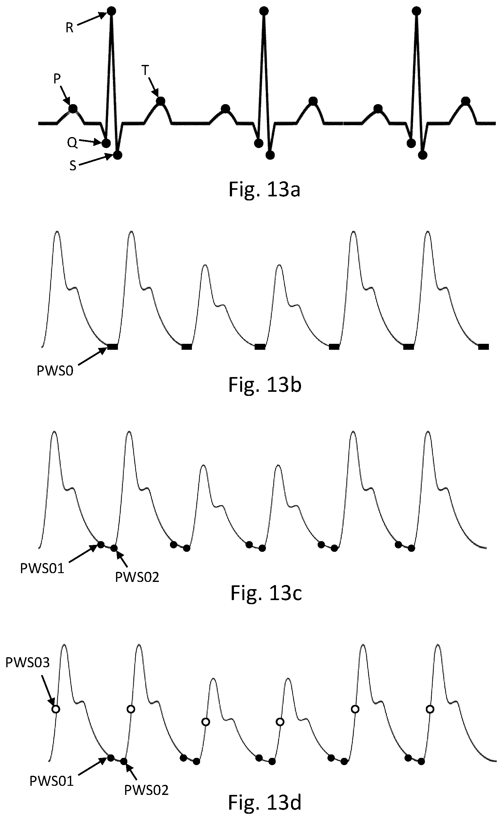 Patent US12588824 Figure 9 – Cardiac pulse wave retrieval from an electrical signal