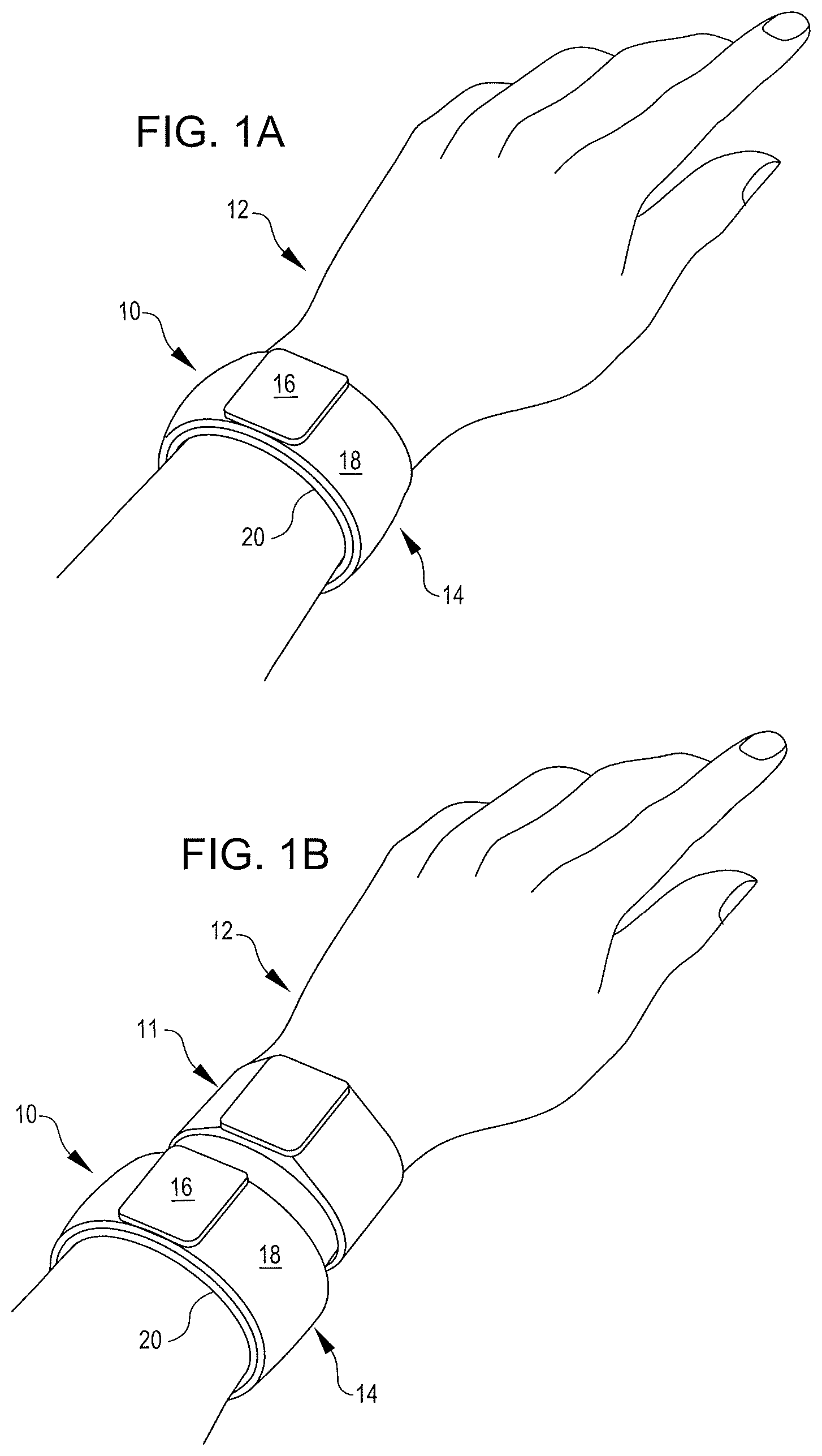 Patent US12588825 Figure 1 – Inflatable cuffs with controllable extensibility